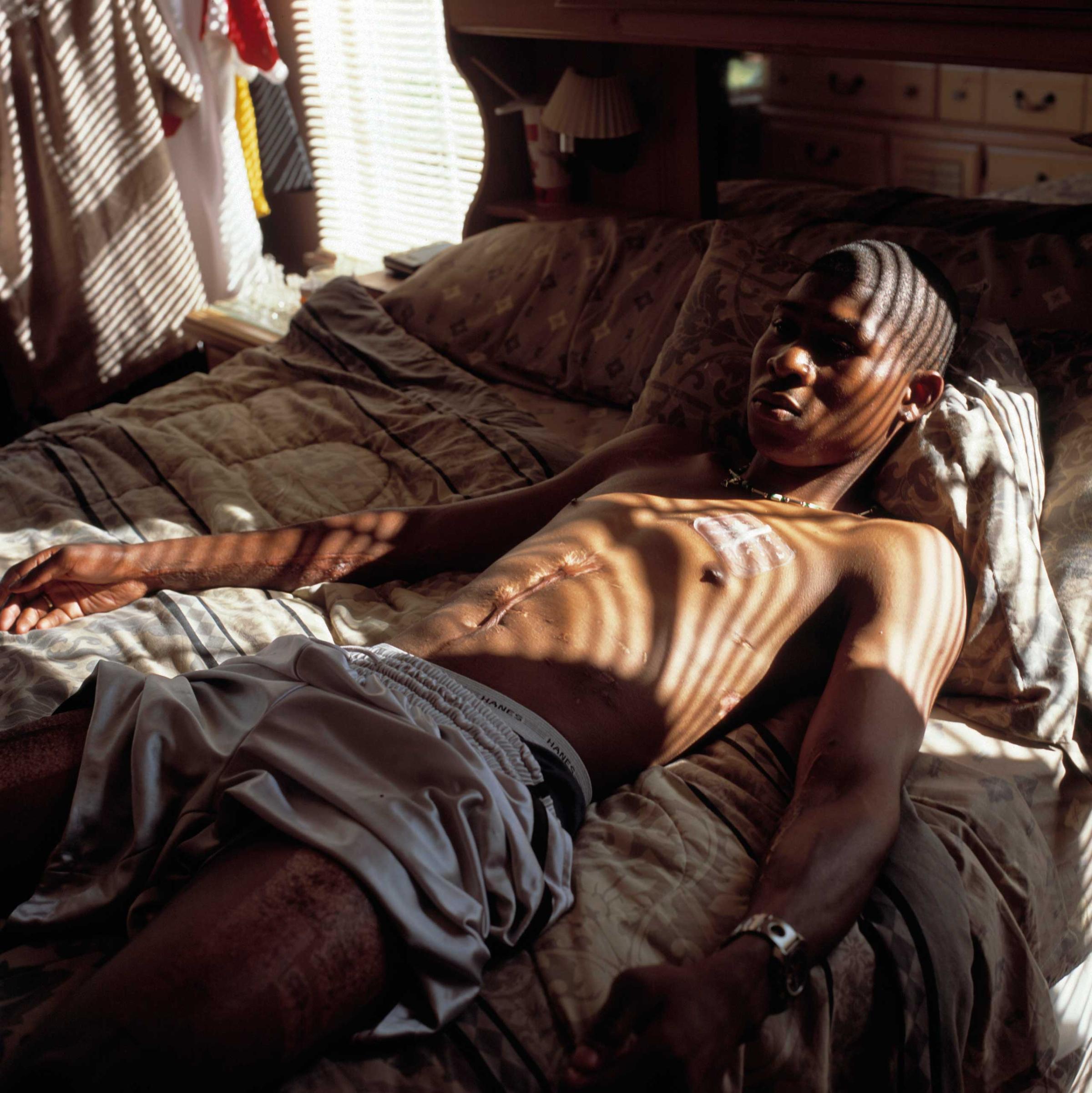 Tyson Johnson III, 22, a corporal and mechanic with Military Intelligence at the Abu Ghraib prison in Baghdad, was injured in a mortar attack. He suffered massive internal injuries. Photographed at his home in Prichard, Alabama,  May 6, 2004.