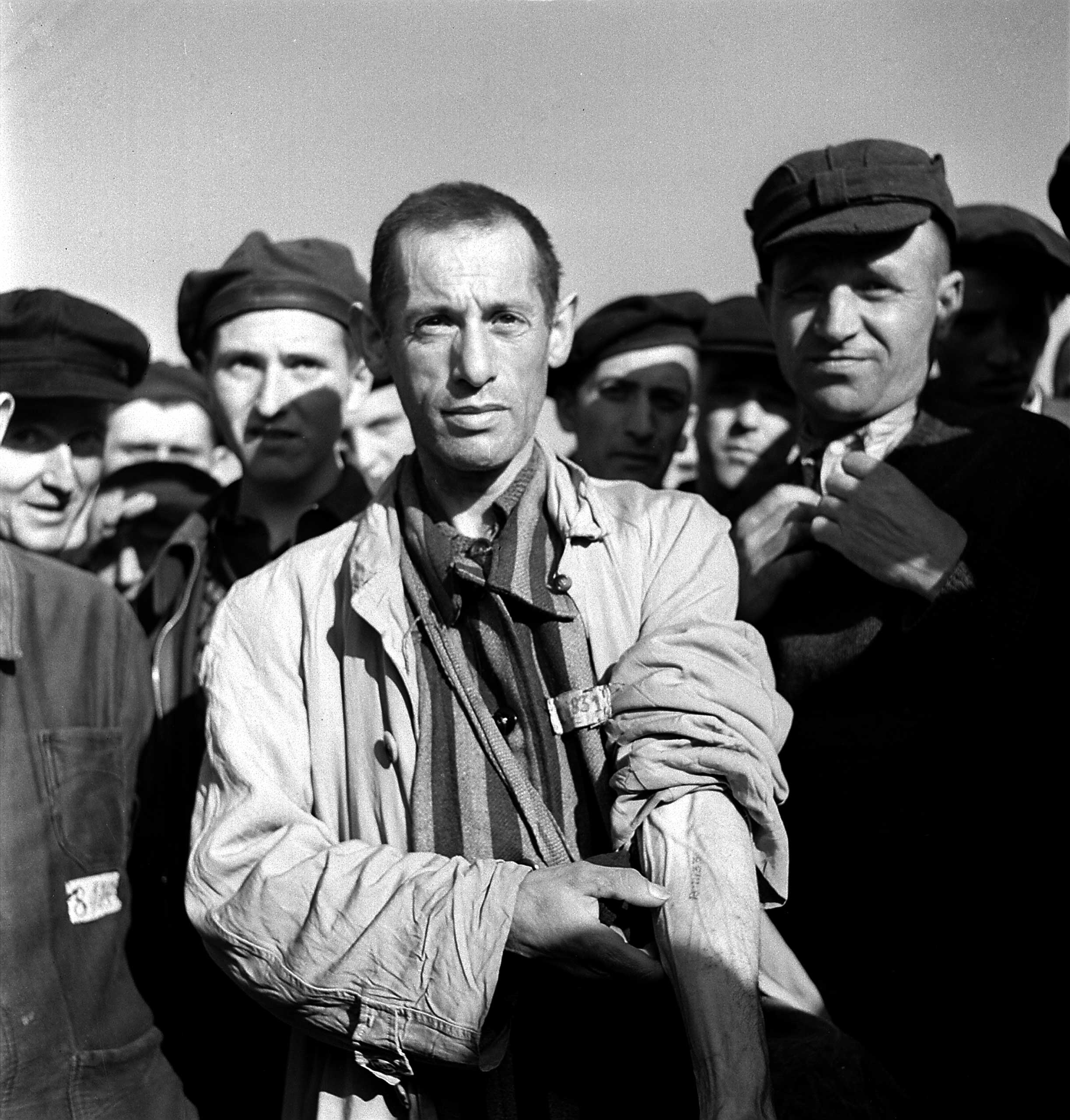 Not published in LIFE. Prisoners at Buchenwald display their identification tattoos shortly after camp's liberation by Allied forces, April 1945.