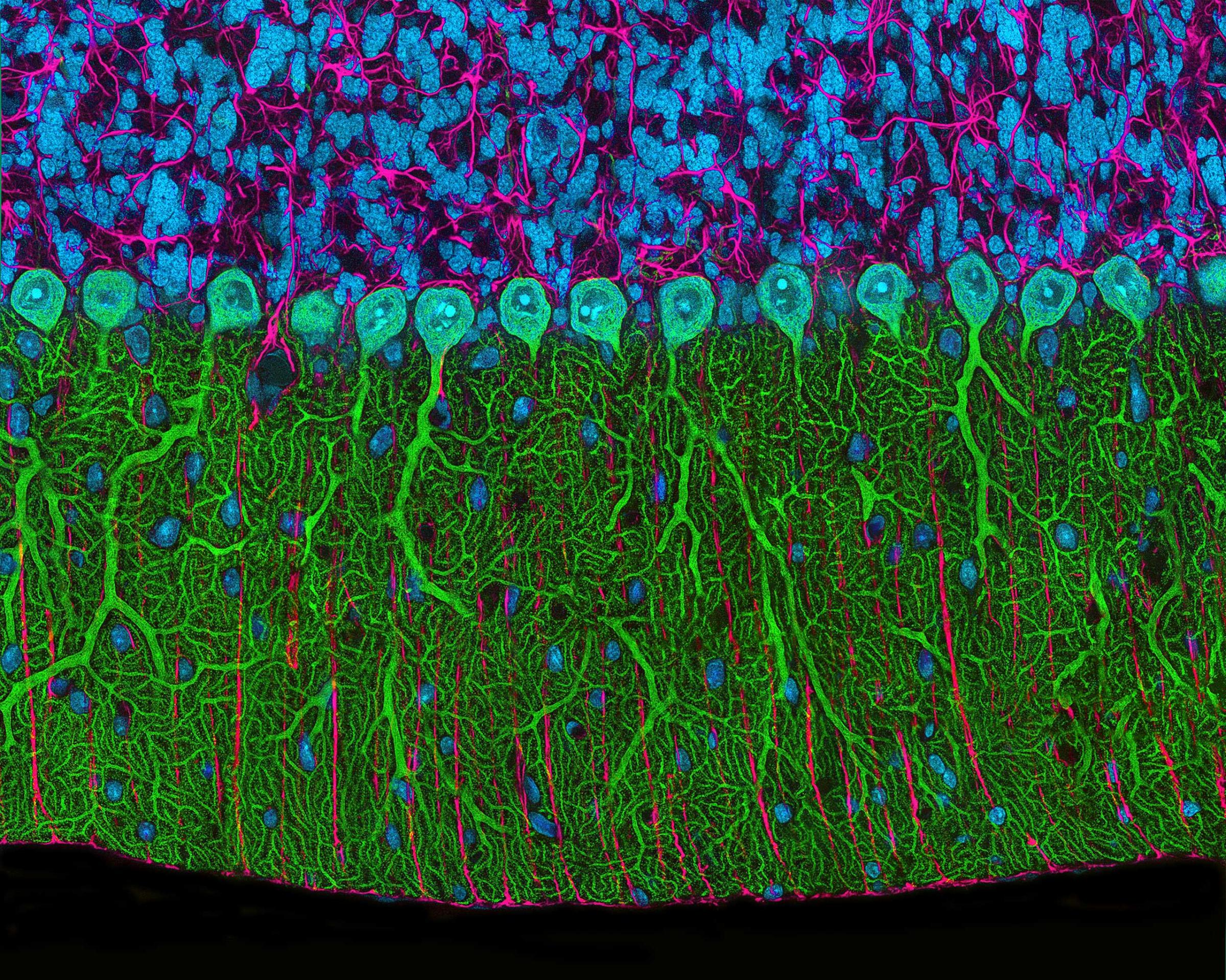 A Rat brain cerebellum at 300x magnification.