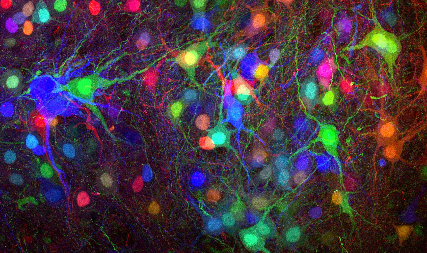 Motoneurons in the brain of a mouse at 60x magnification.