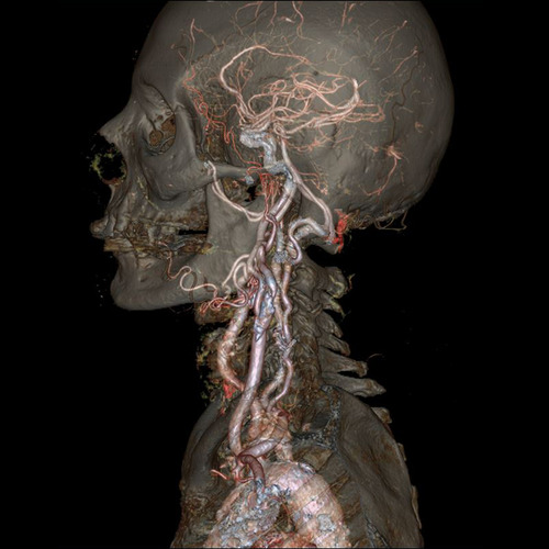CT Scanner Image
