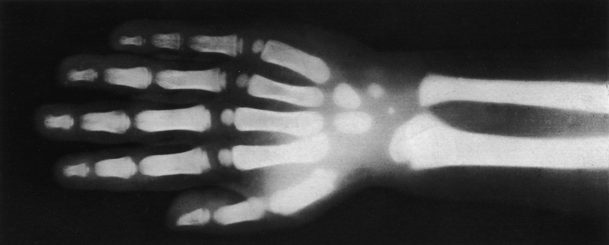 Circa 1890: an X-Ray view of the hand and wrist of a four year-old child (George Eastman House / Getty Images)