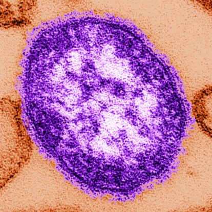 Measles virion (Getty Images)