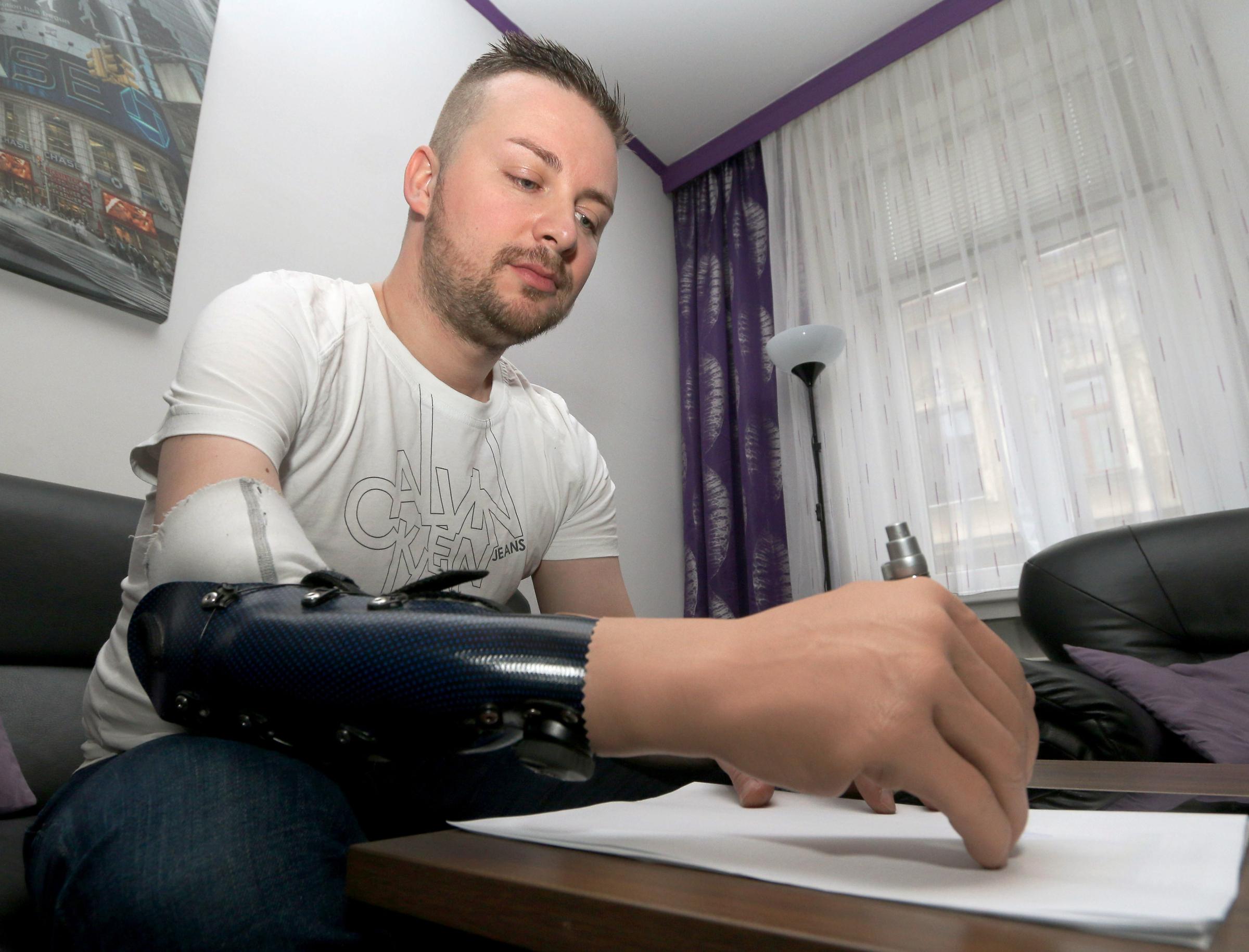 Milorad Marinkovic demonstrates writing with his bionic hand as he poses for a photograph at his home in Vienna, Austria, Tuesday, Feb. 24, 2015. Three Austrians have replaced injured hands with bionic ones that they can control using nerves and muscles transplanted into their arms from their legs. The three men are the first to undergo what doctors refer to as bionic reconstruction, which includes voluntary amputation, transplantation of nerves and muscles and learning to use faint signals from them to command the hand. (AP Photo/Ronald Zak)