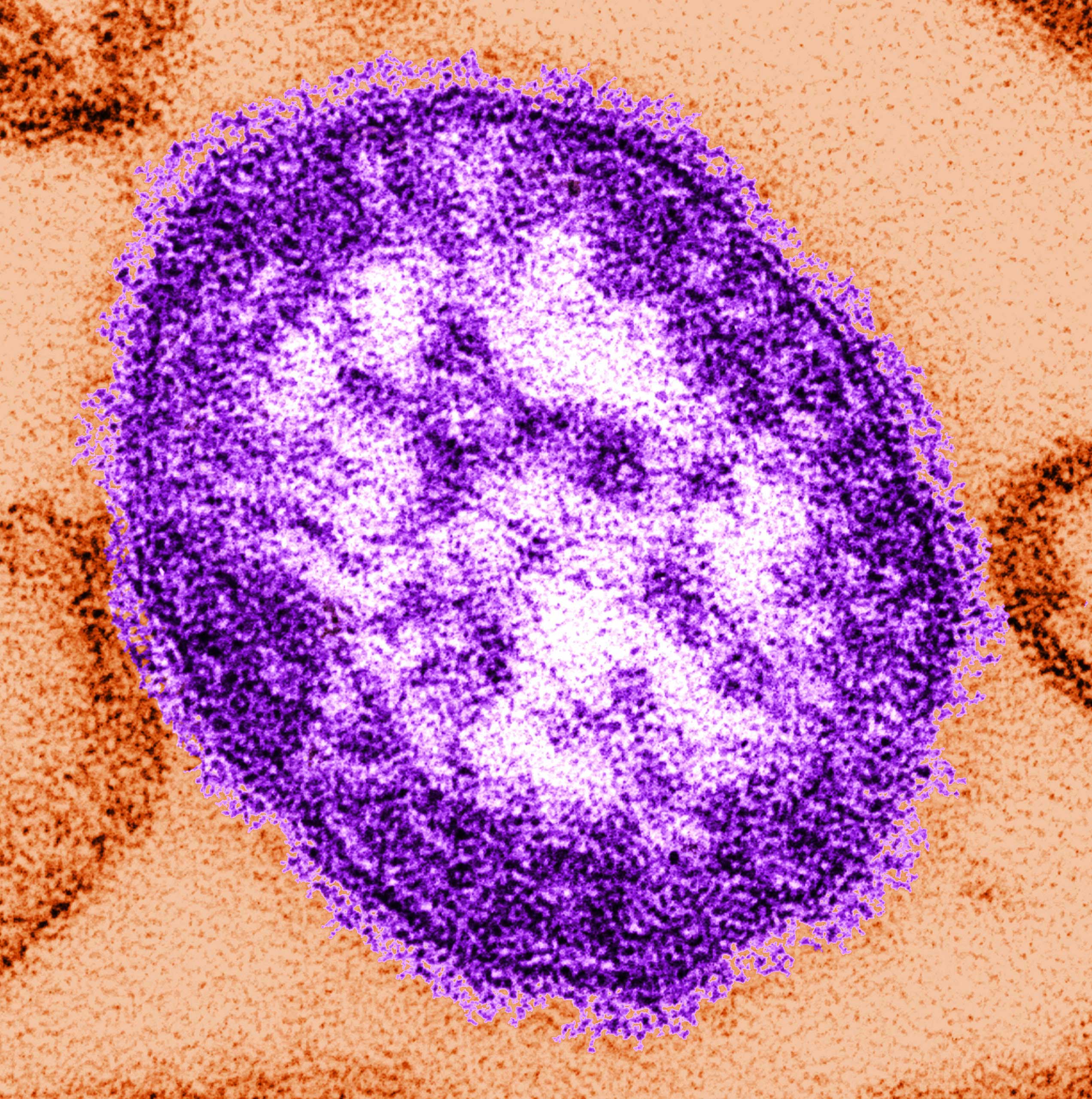 A thin-section transmission electron micrograph (TEM) reveals the ultrastructural appearance of a single virus particle, or "virion", of measles virus. (CDC/Getty Images)