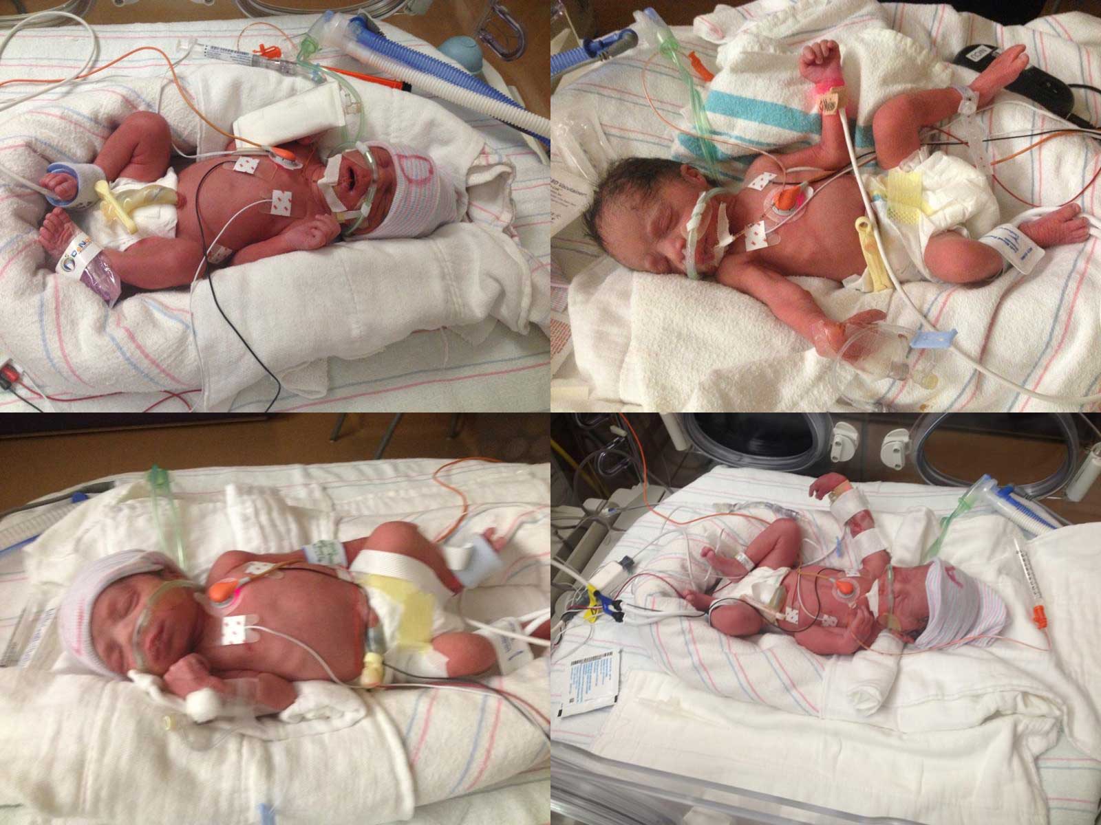 Quadruplets born to Erica Morales at a Phoenix hospital on Jan. 15, 2015 (Nicole Todman—AP)