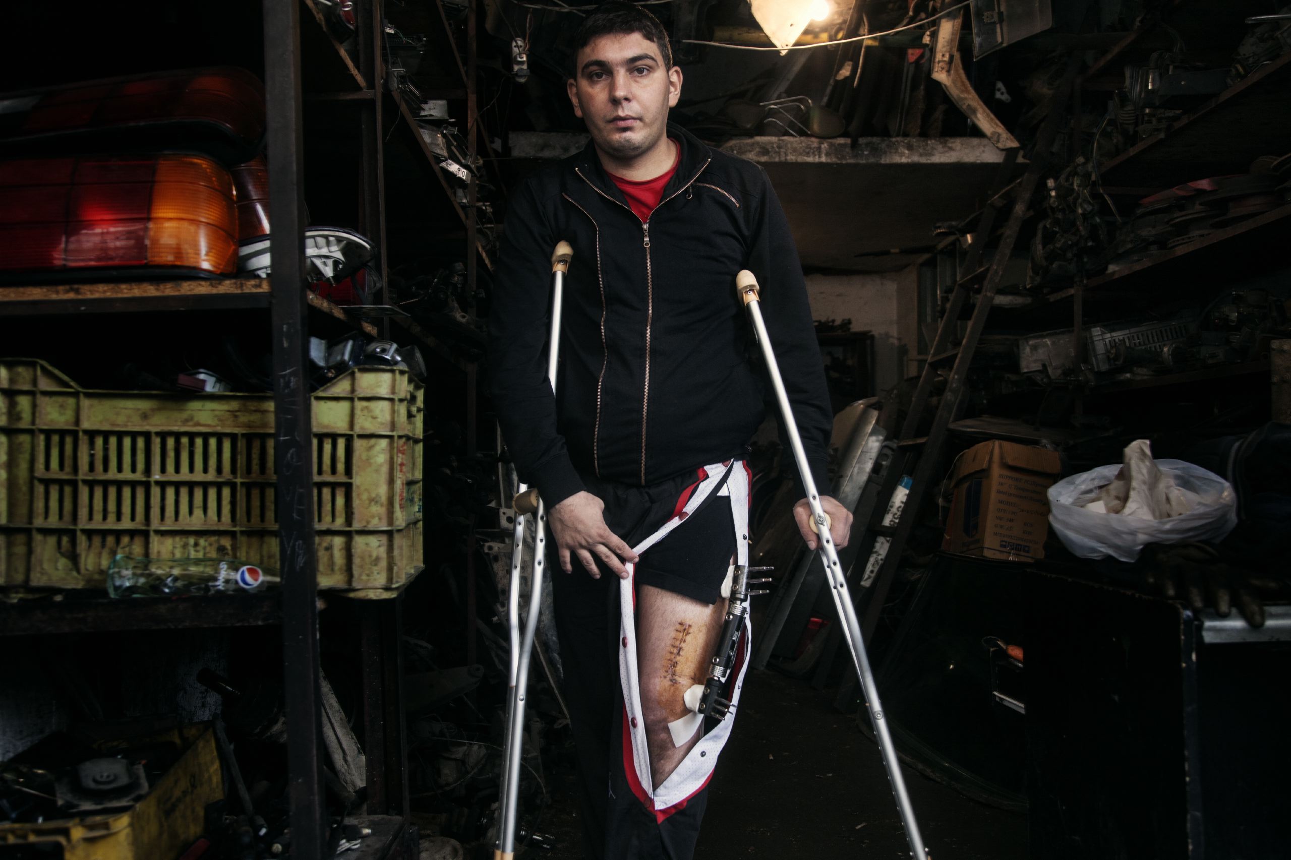 Abdallah Mohammed, 25, shows the wound he sustained during the shelling of Bab al-Tabbaneh, Tripoli, Lebanon, Nov. and Dec. 2014.
