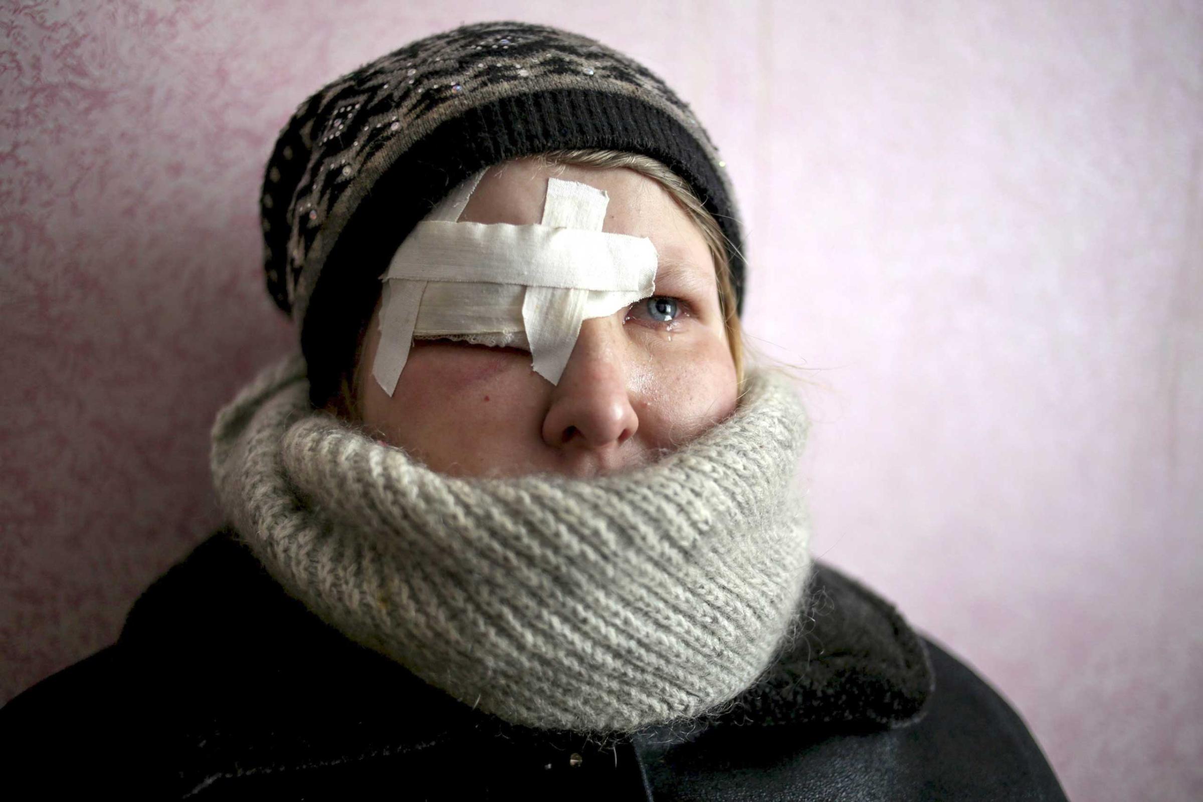 Yulia Novomlynets, 18, waits in a line to receive the humanitarian aid in the local House of Culture, which is used as a bomb shelter in Mironovka village, near Debaltseve of Donetsk area, Feb. 17, 2015.