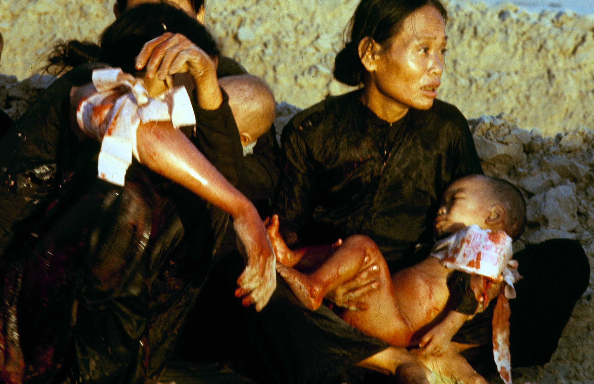 The mother of the wounded baby, numbed by shock, was guided like a blind person out of the battle zone. Now she sits amongst wounded villagers, clinging to her dying child. After bandaging the little boy as best he could, the medic returned him to the mother so he could rejoin his outfit. Soon afterward, the baby was airlifted to a hospital ship off-shore, where Navy doctors worked frantically but unsuccessfully to save him.