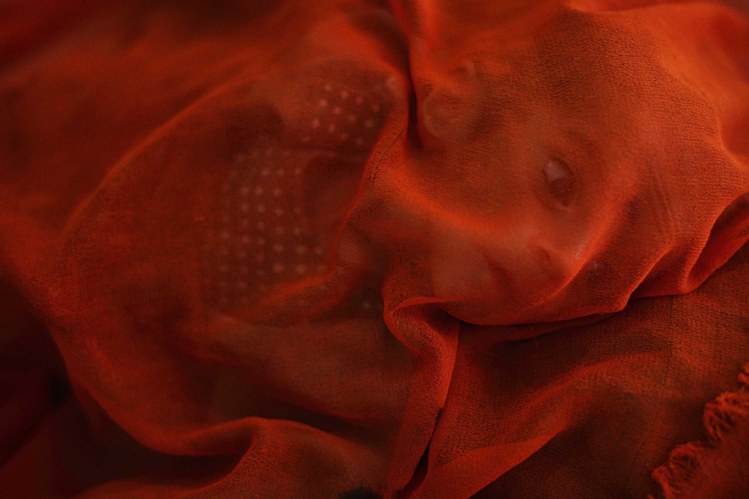 Gul Ahmad, an infant boy suffering from acute malnutrition, is covered by his mother's scarf while being treated in the therapeutic feeding center ward at the Doctors Without Borders (MSF) administered Boost Hospital in Lashkar Gah, Helmand province, Afghanistan on April 6, 2015. (Andrew Quilty—Oculi)
