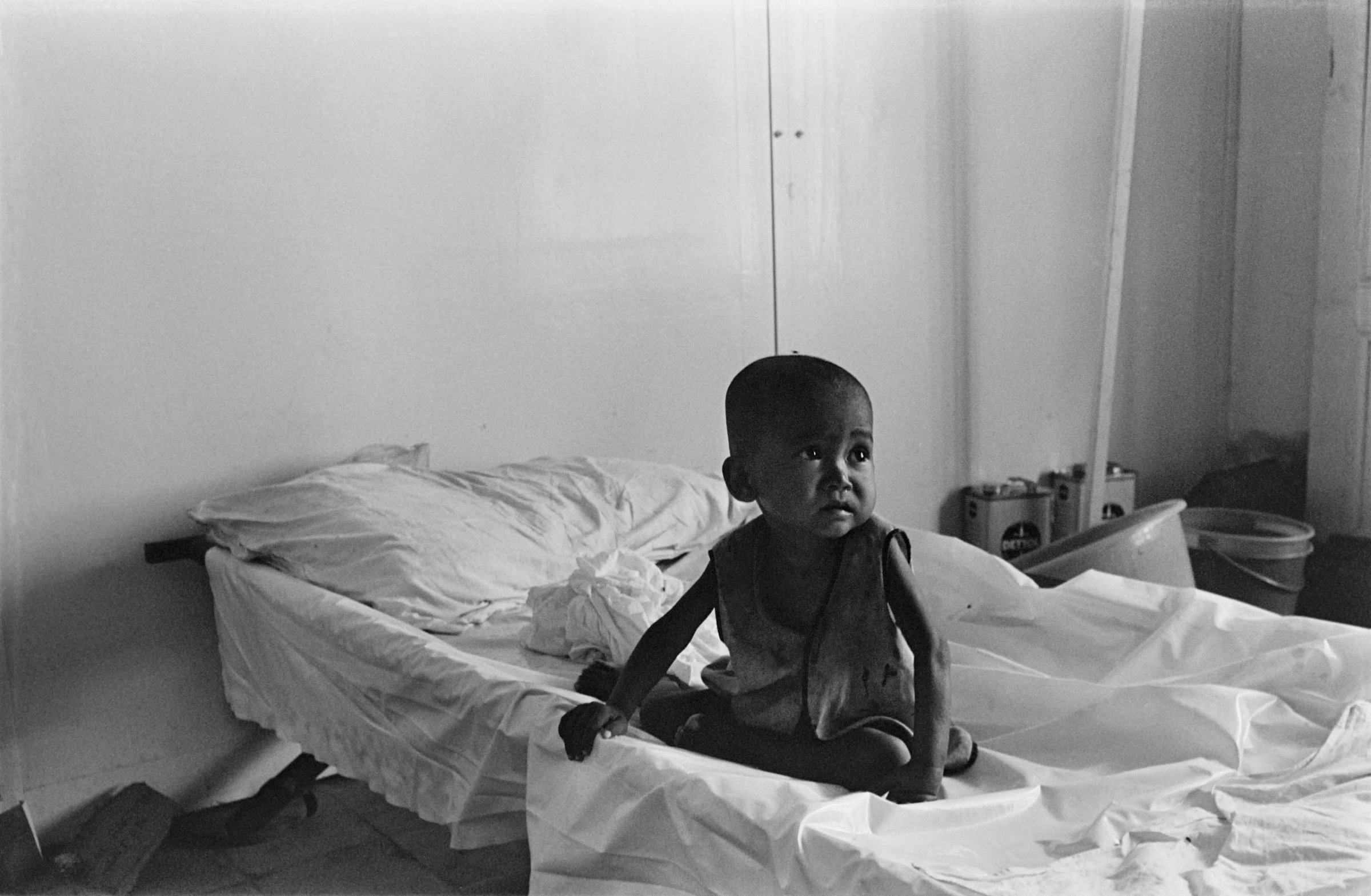 Young Cambodian child at a hospital in Phnom Penh, in March 1975.