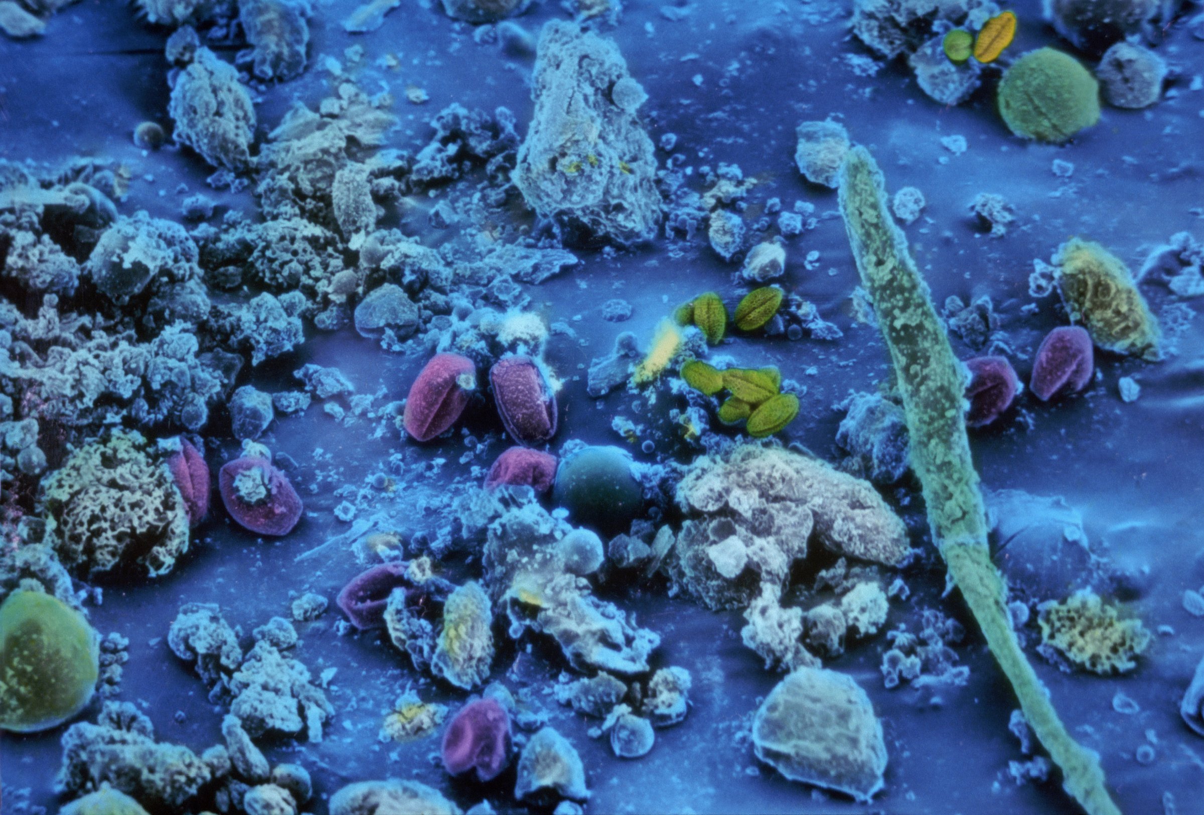 dust microbes dna