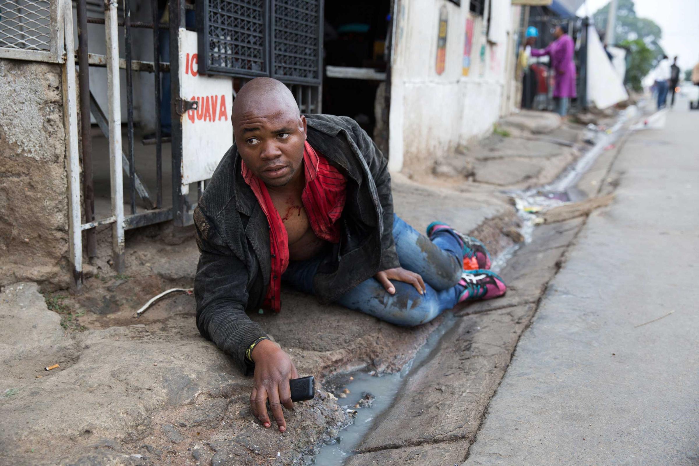 Sithole after being attacked by men in Alexandra township during anti-immigrant violence in Johannesburg on April 18, 2015.