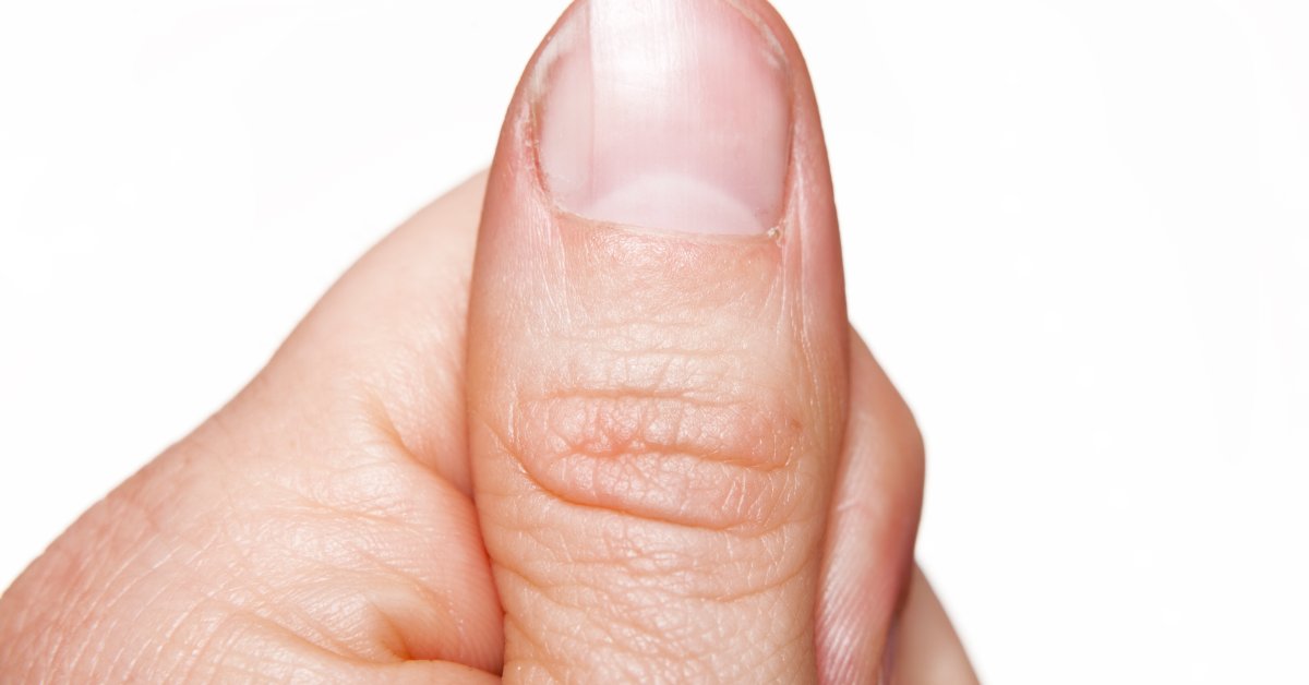 Ногти на больших пальцев мужчин