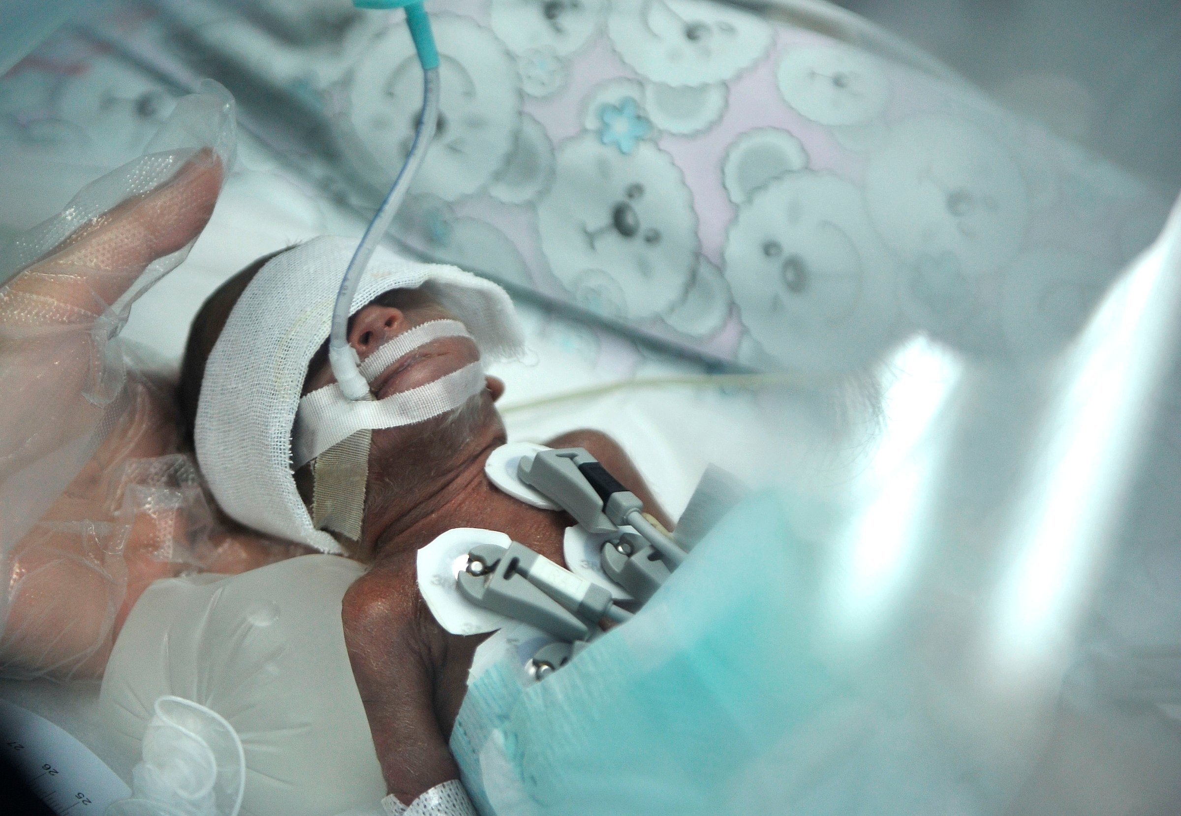 A pound and a half of life: This baby was born in 2014 at 23 weeks in Sichuan China.
