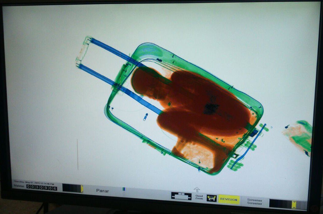 An X-ray image showing an 8-year-old sub-Saharan boy hidden in a suitcase on May 8, 2015, in Ceuta the Spanish enclave north of Morocco. (Spanish Guardia Civil/AFP/Getty Images)