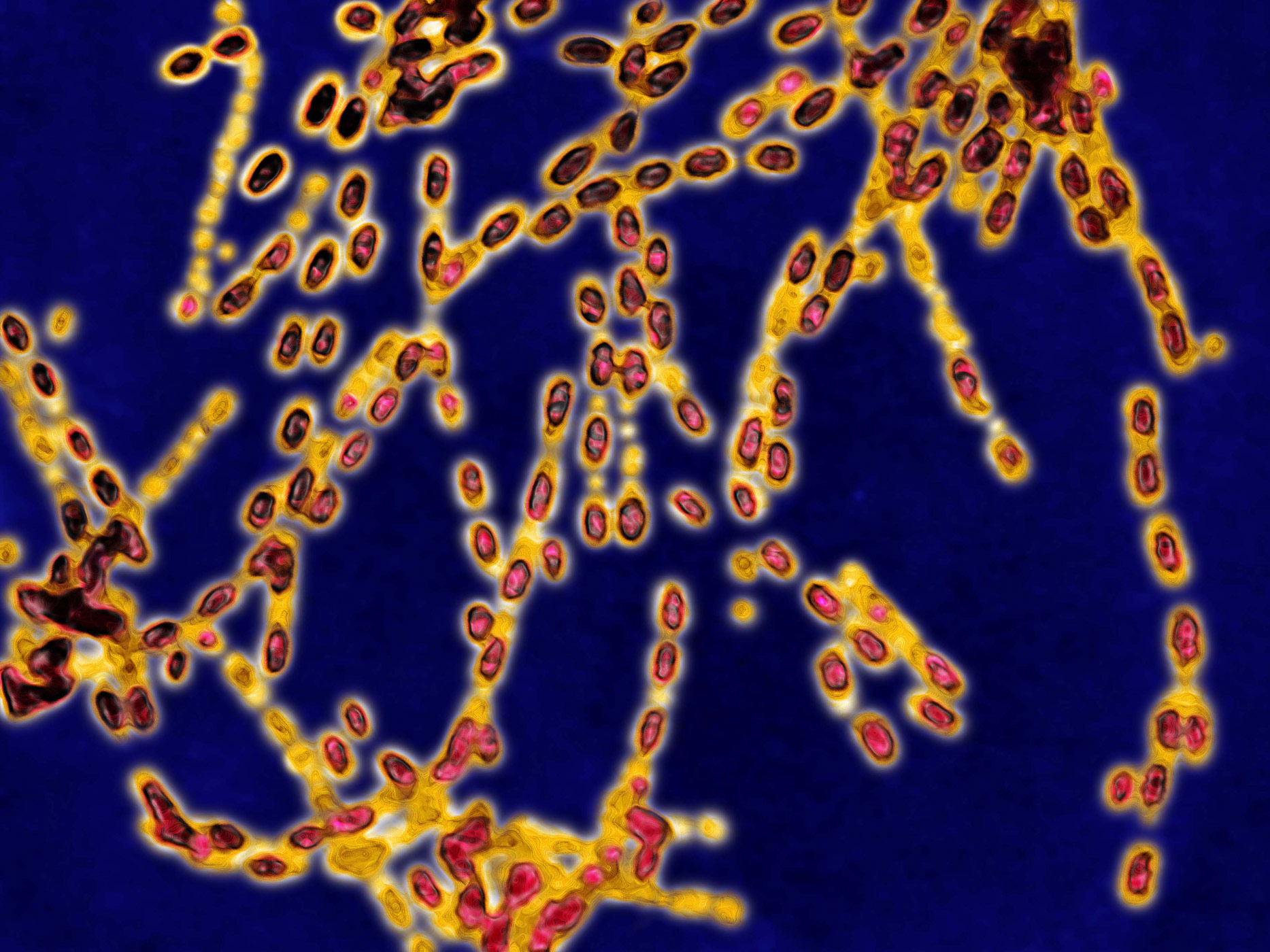 Anthrax Bacterium (Getty Images)