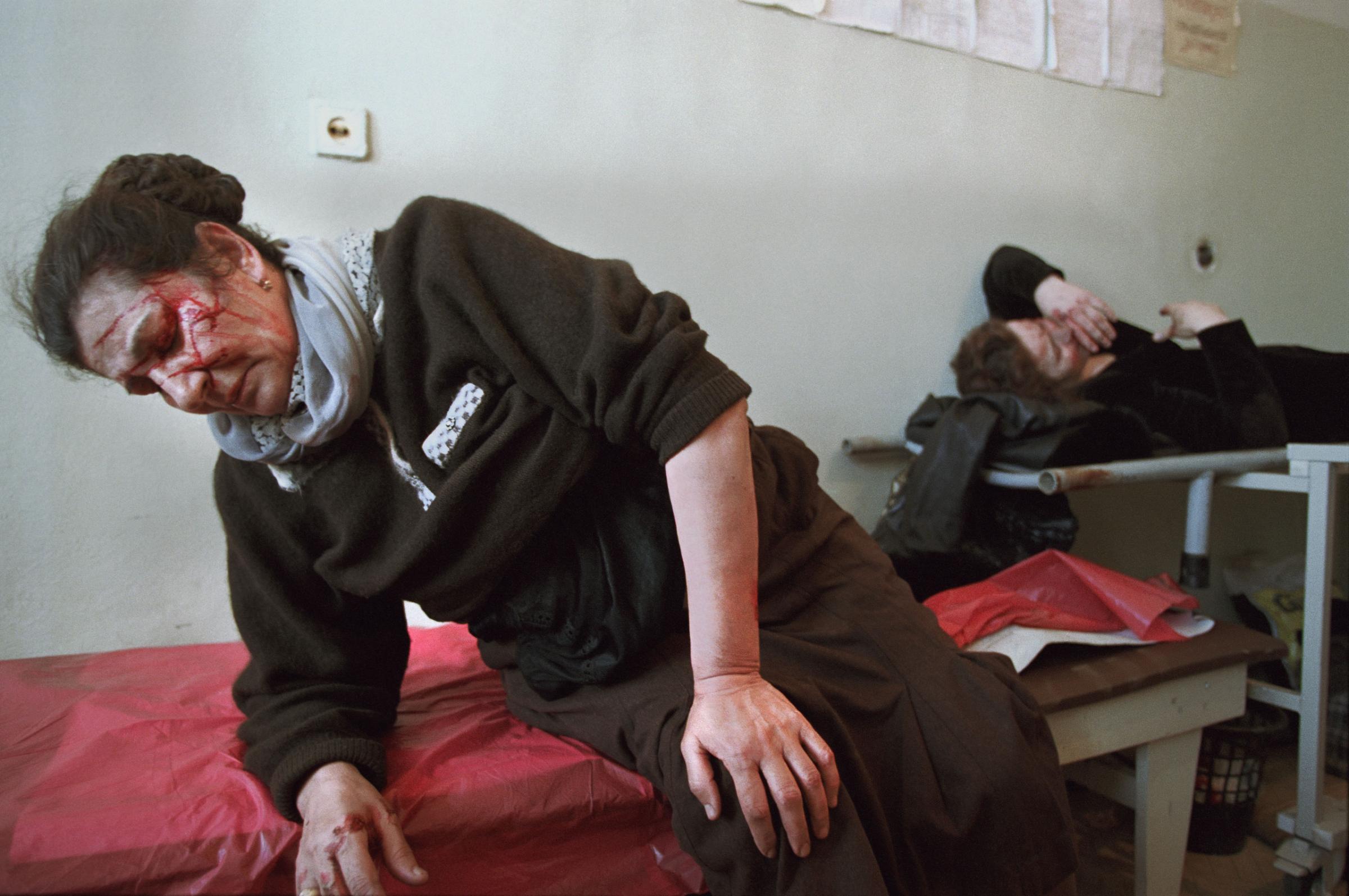 Civilians are treated at a hospital in Grozny, Chechnya, March 2002. More than a dozen were injured after a Russian Army APC ran into a civilian bus. Yuri kozyrev—NOOR