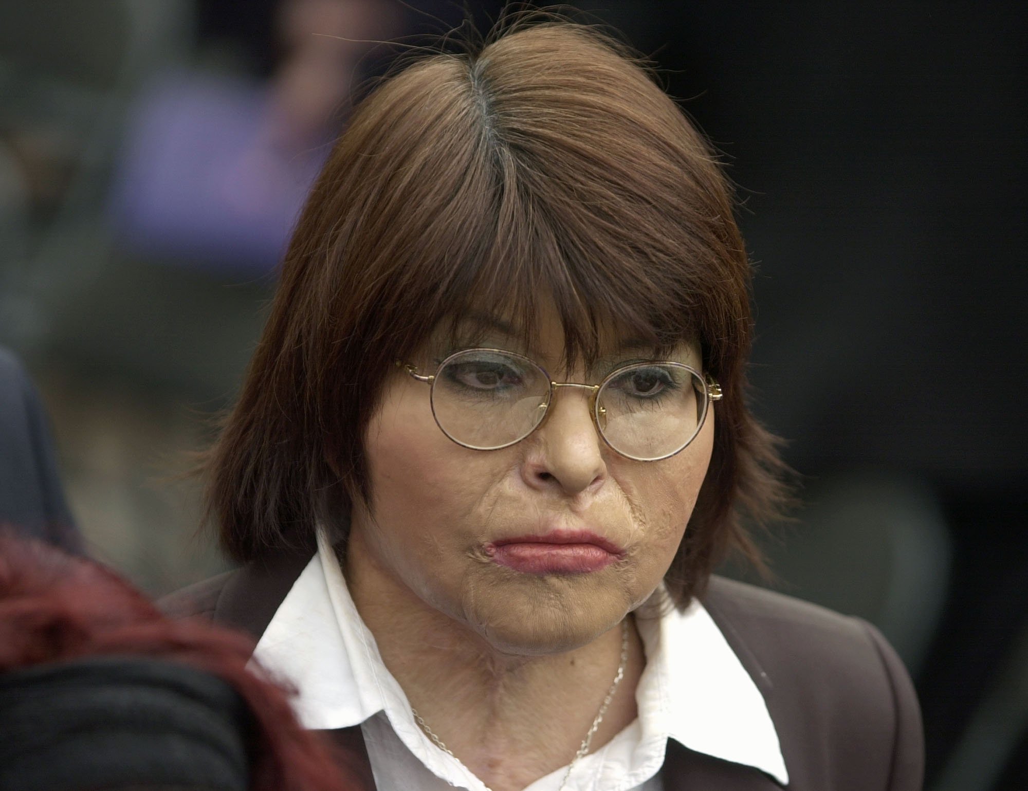 Chilean Carmen Gloria Quintana attends a ceremony marking the 30th anniversary of the Sept. 11 military coup lead by Gen. Augusto Pinochet at the government palace La Moneda, in Santiago on Sept. 11, 2003.