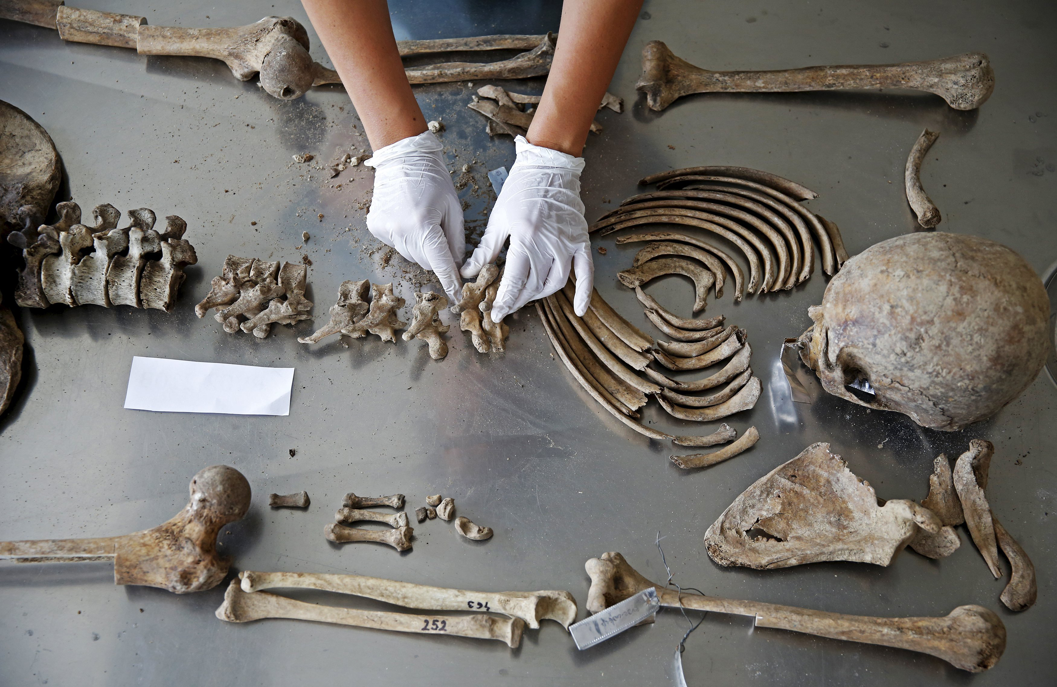 Senior Forensic Anthropologist Dragana Vucetic of the International Commission on Missing Persons (ICMP) works to attempt to identify the remains of a victim of the Srebrenica massacre, at the ICMP centre near Tuzla, Bosnia on June 11, 2015.