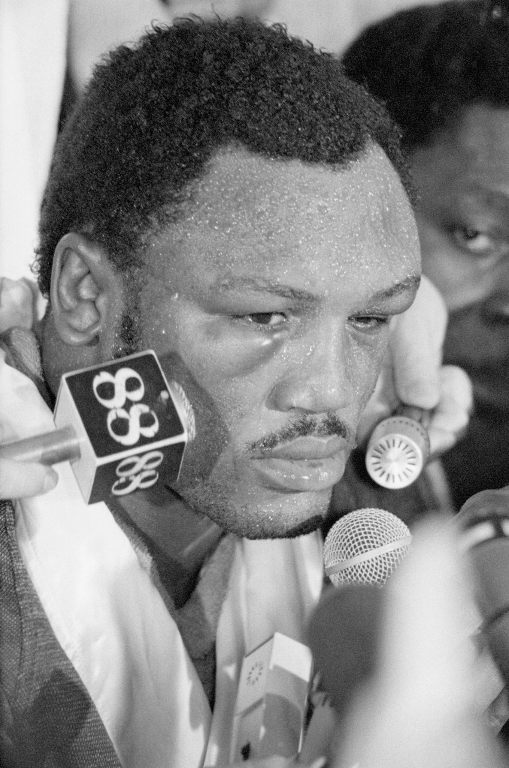 Challenger Joe Frazier, showing puffed eyes, talks to members of the press after suffering a TKO in the 14th round of his 15-round heavyweight championship match against champion Muhammad Ali. Manila, Luzon Island, Philippines, October 1, 1975.