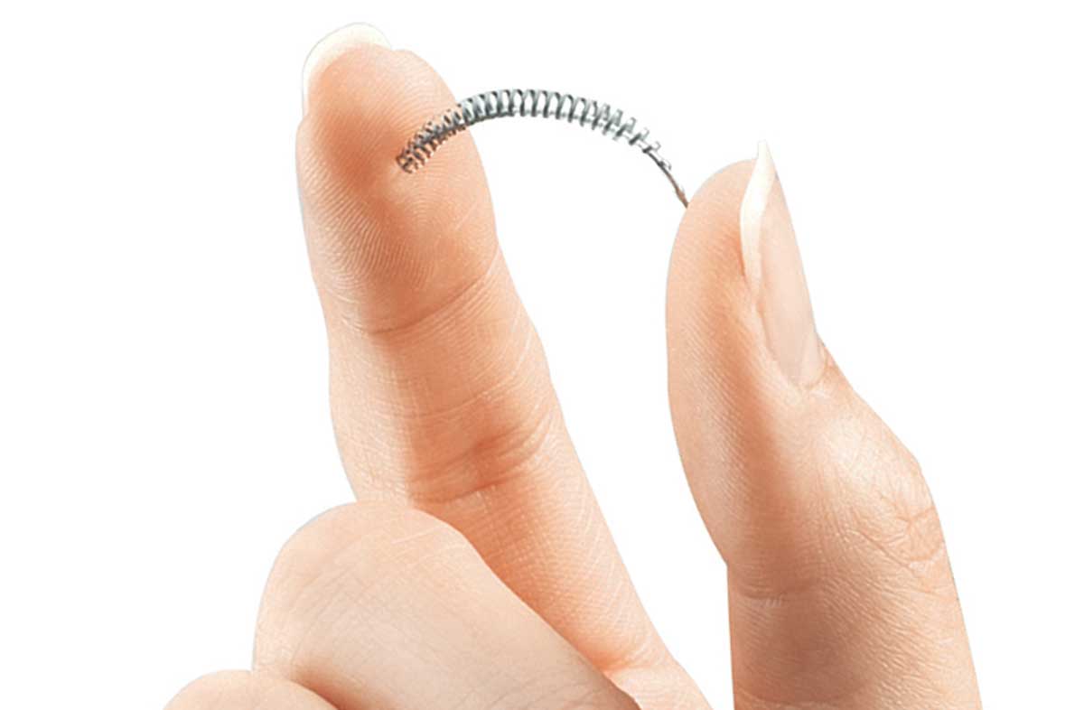 This product image provided by Bayer Healthcare Pharmaceuticals, Inc. shows the birth control implant called Essure. (AP)