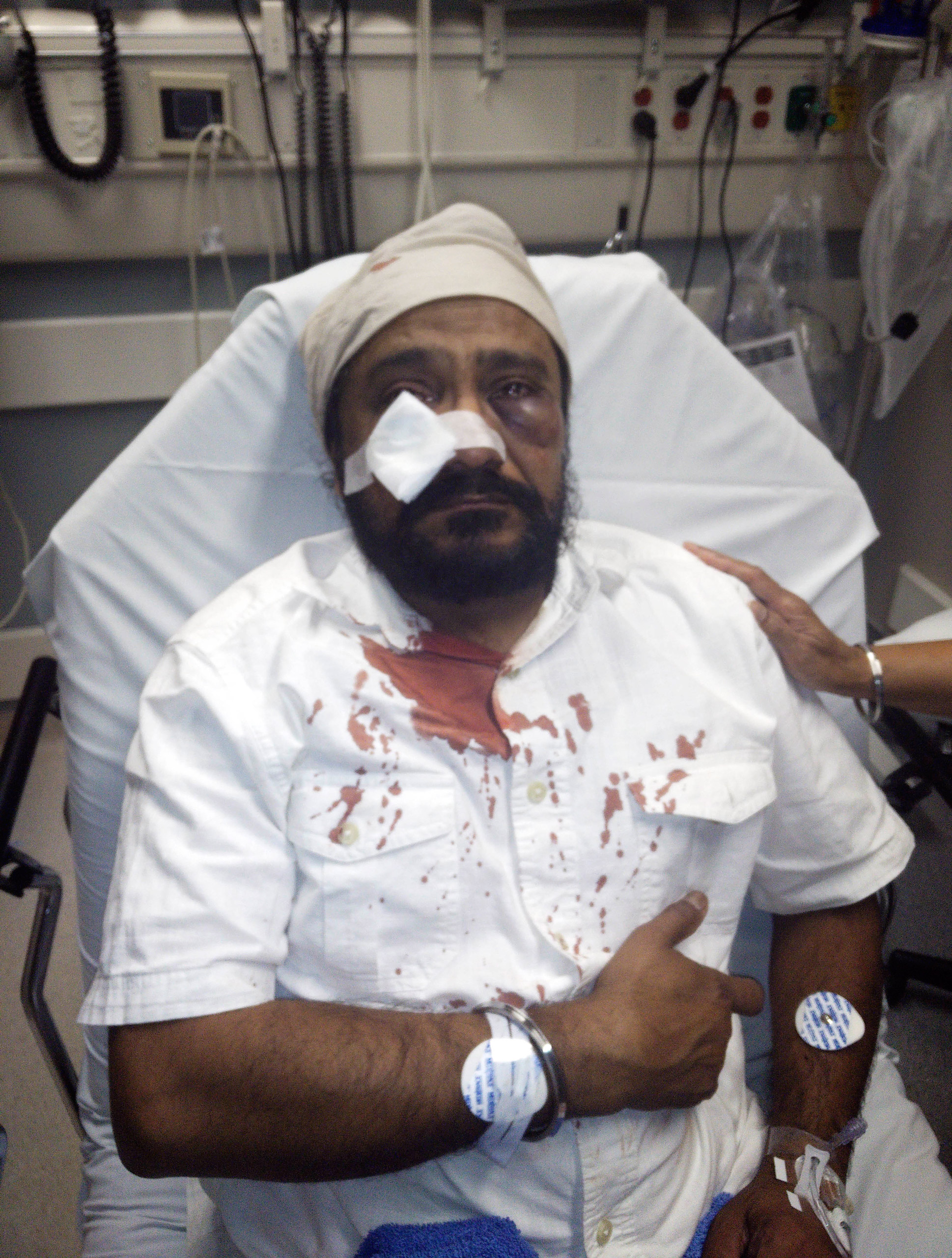 In this photo provided by The Sikh Coaliton, 53-year-old Inderjit Mukker is seen at a hospital in Hinsdale, Ill., on Sept. 8, 2015. (The Sikh Coalition/AP)