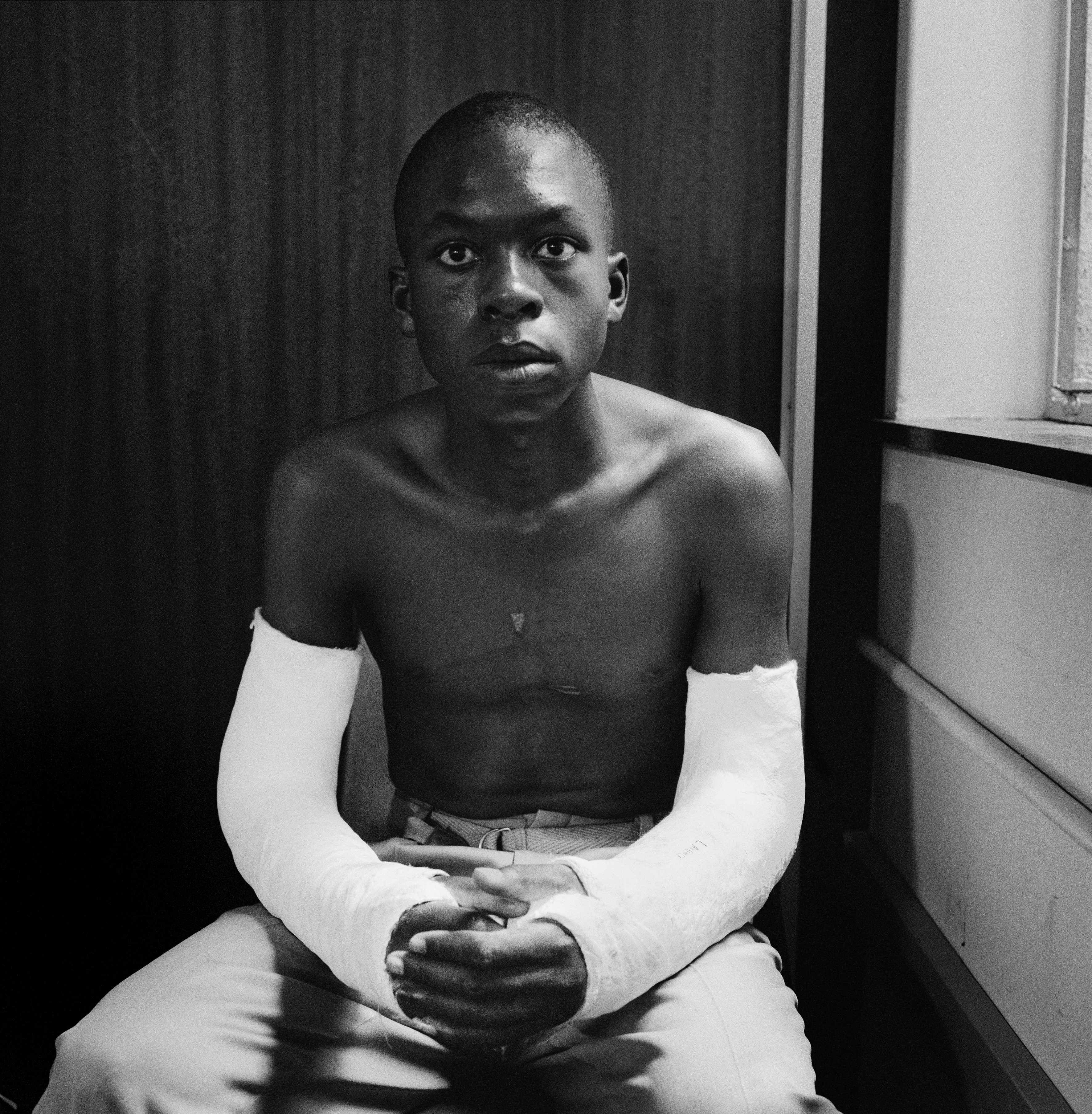 Lawrence Matjee after his assault and detention by
                              the Security Police. Khotso House, de Villiers Street (1985).