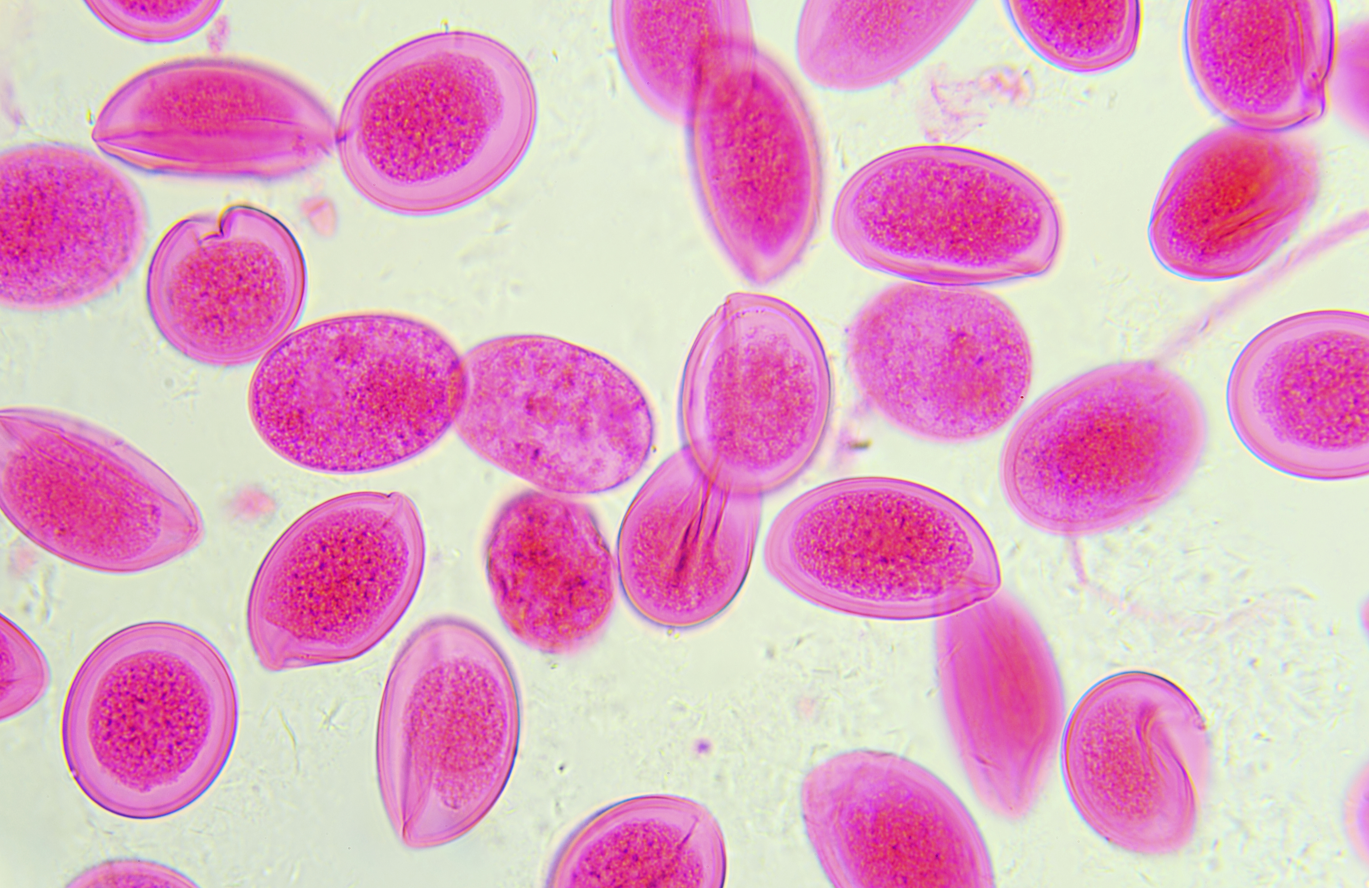 Ascaris Lumbricoides unfertilized eggs under a microscope. (Getty Images)