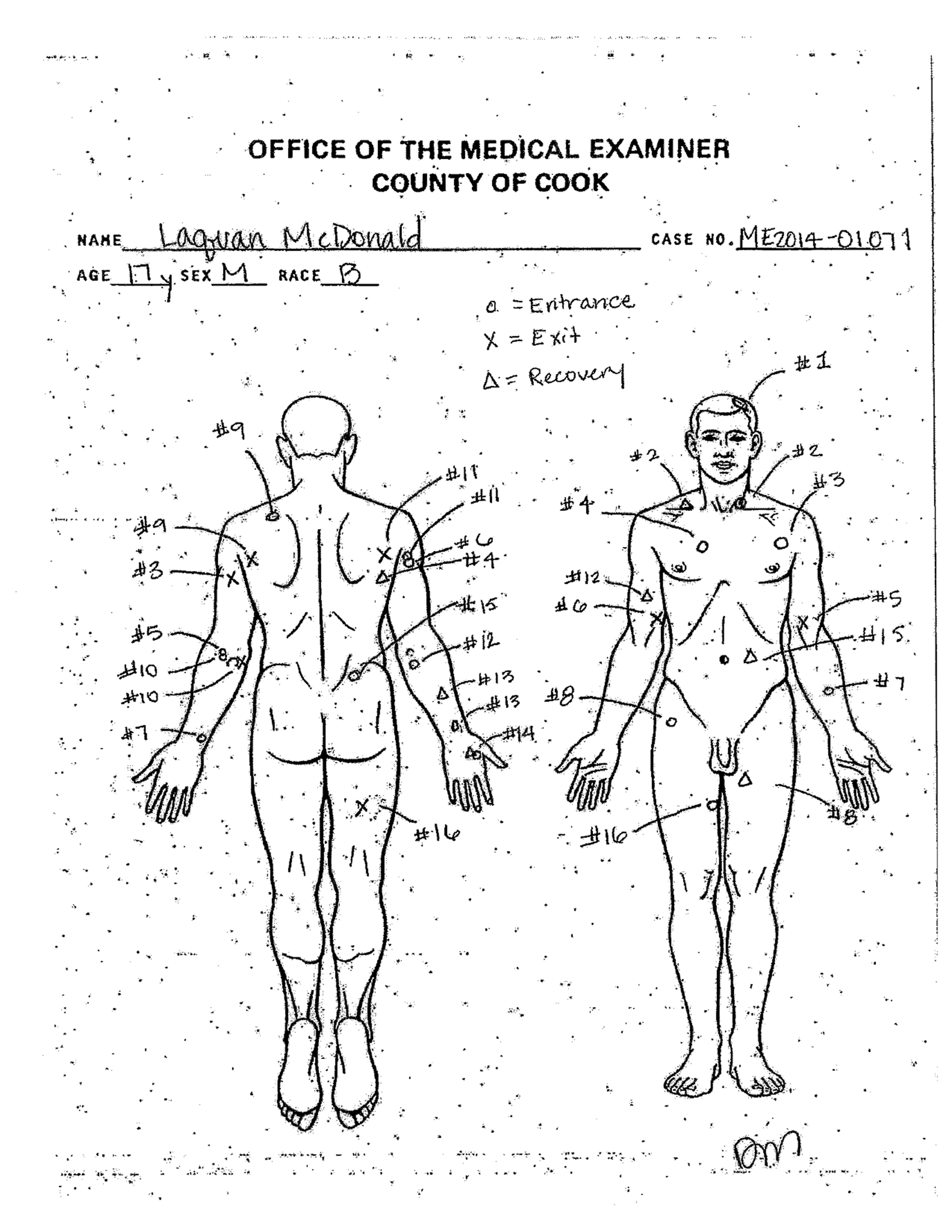 Autopsy diagram showing the location of wounds on the body Laquan McDonald, shot by a Chicago Police officer 16 times on Oct. 20, 2014. (Cook County Medical Examiner's office/AP)