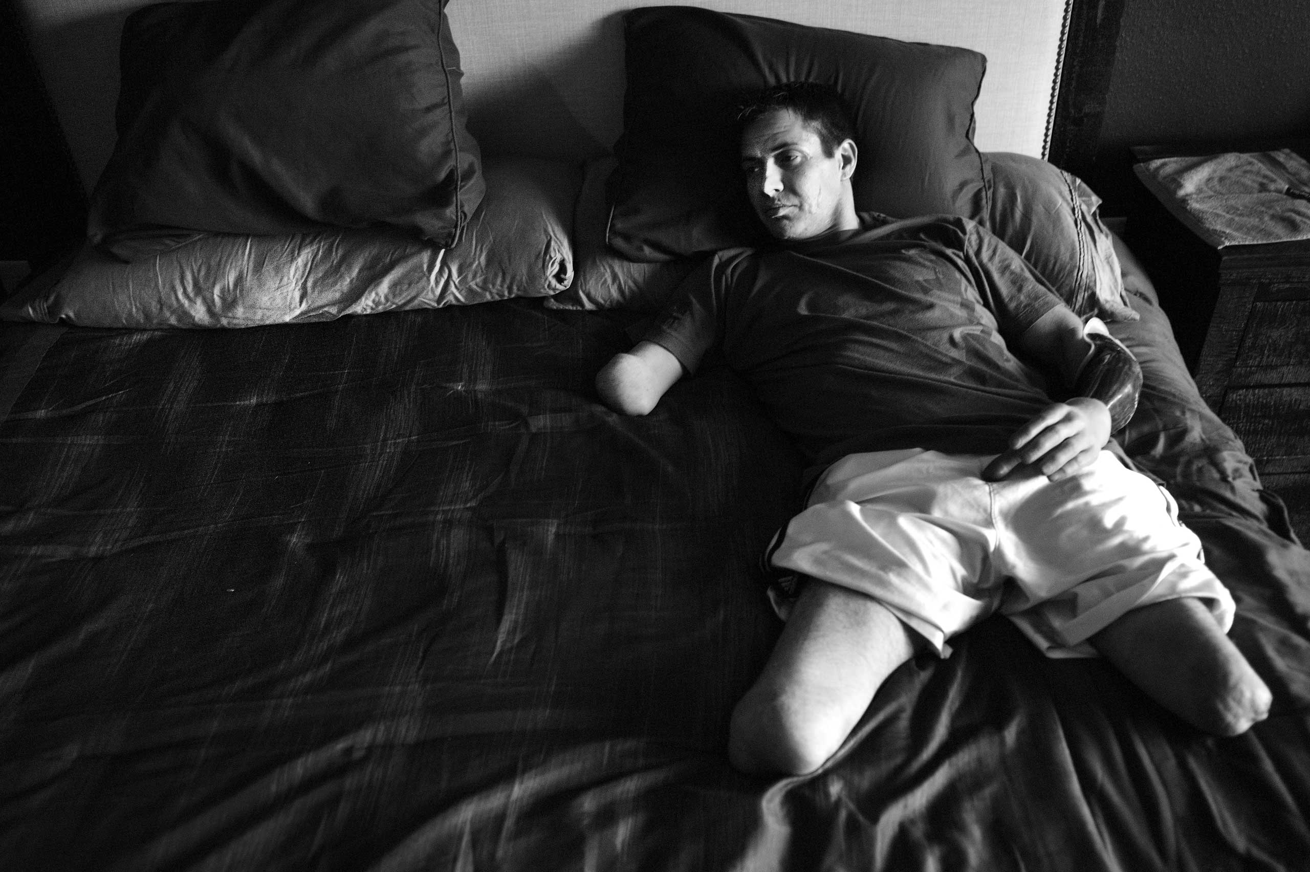 Corporal Todd Nicely, a quadruple amputee Marine who lost his limbs after he stepped on an improvised explosive device in Afghanistan, resting in his bedroom, at home, in Lake Ozark, Miss, 2014.