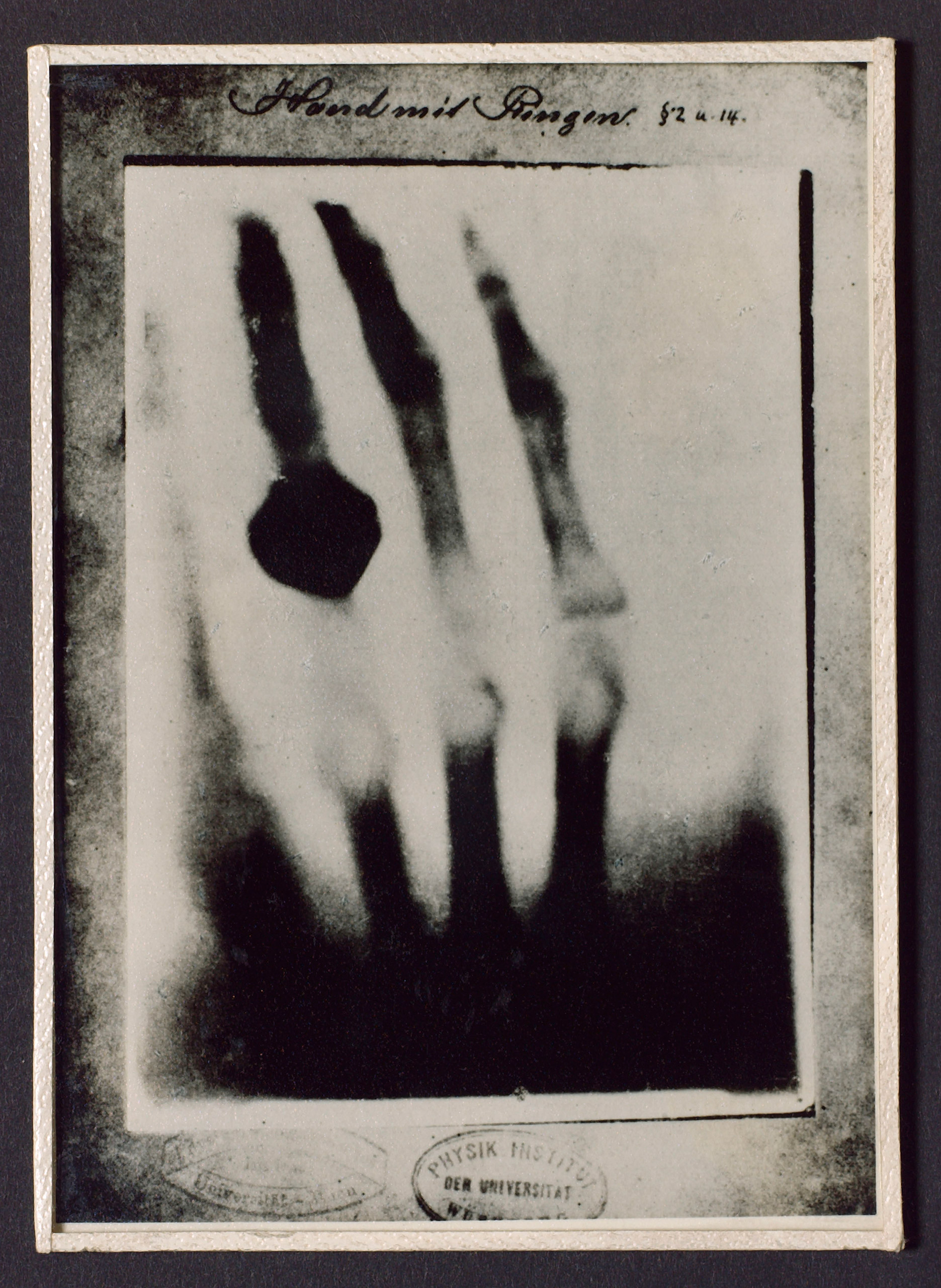 X-ray photograph taken by Wilhelm Roentgen of his wife's hand in December 1895. (SSPL—Getty Images)