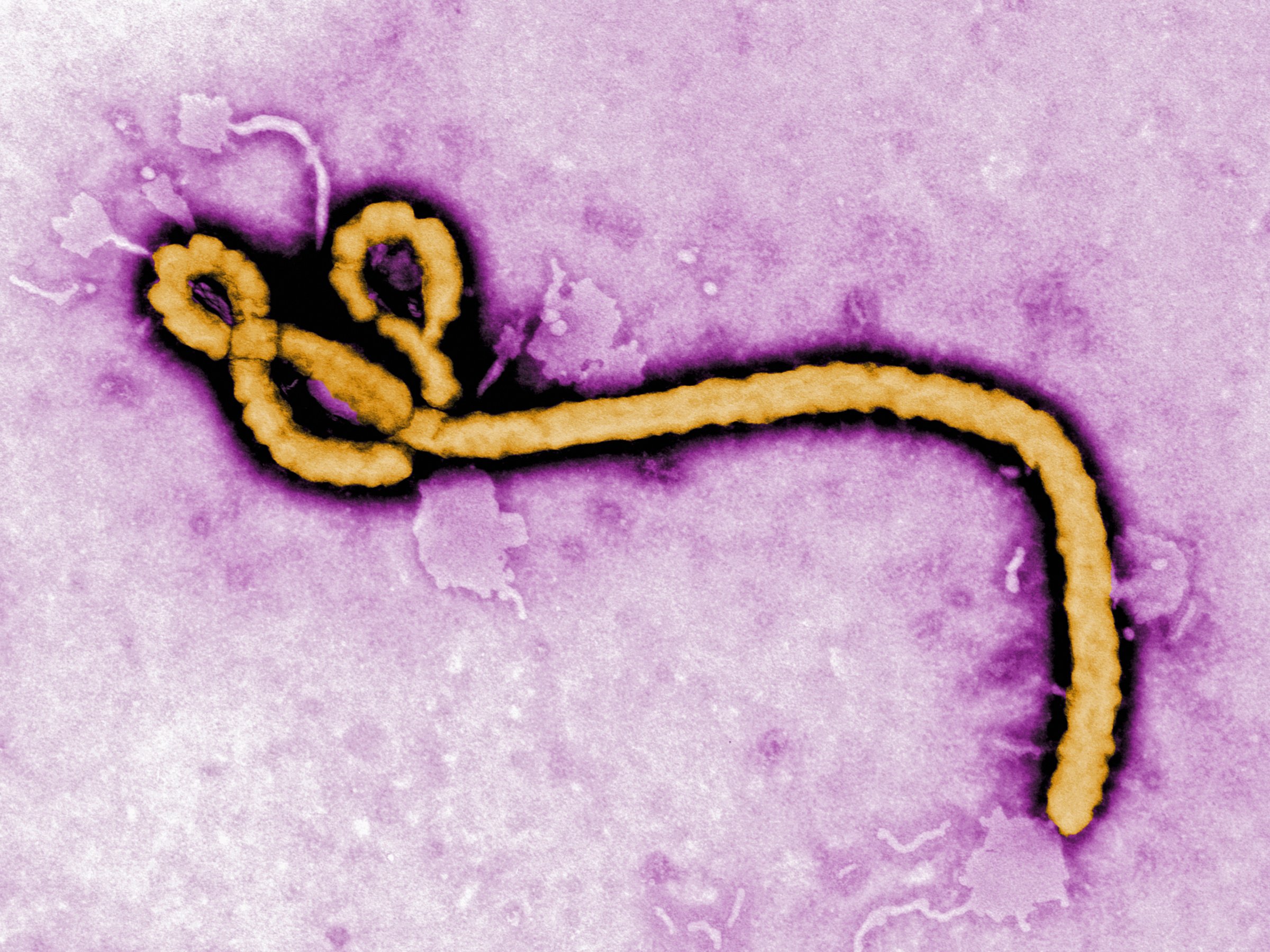 Ebola virus health problems