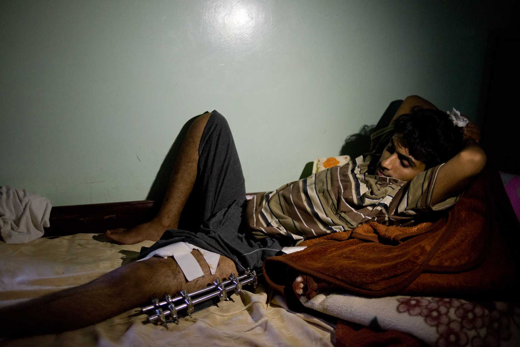 A young Yemeni man lays recovering from his injuries in Amran Hospital on Tuesday, July 7, 2015 in Amran, Yemen.