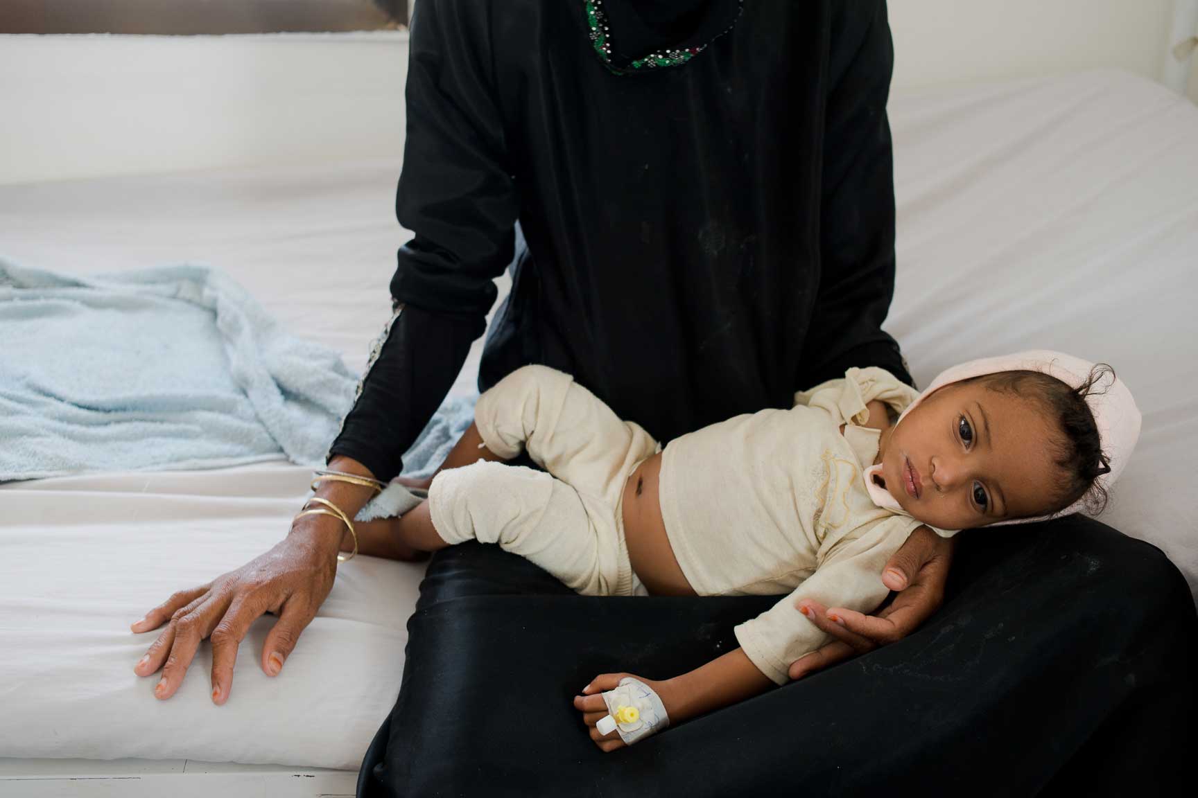 A Yemeni mother holds her malnourished daughter in the children's ward of MSF-supported al Salam Hospital on July 7, 2015 in Amran, Yemen. The mother was too malnourished to breastfeed, and couldn't afford formula or fresh powdered milk. The powder she bought turned out to be spoiled, and her daughter fell ill for weeks.
