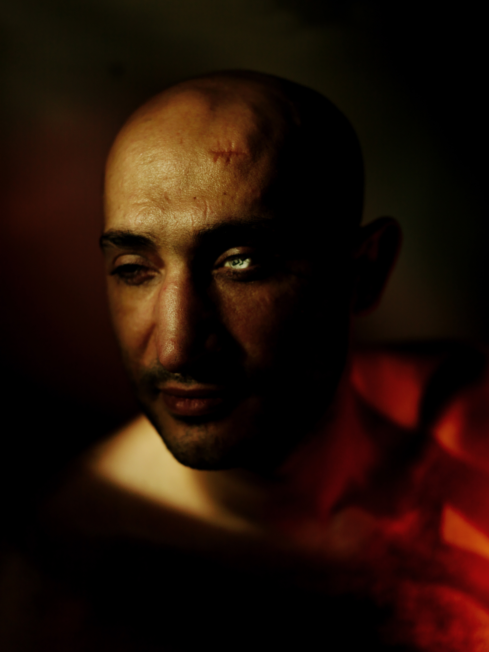 Ahmed Hararah, poses with his left emptied socket, wearing
                              a glass eye on which is written in Arabic, 'Horreya' (in English, 'freedom'). He lost both of his eyes fighting for the revolution. Cairo, Egypt, Oct. 28, 2015.
