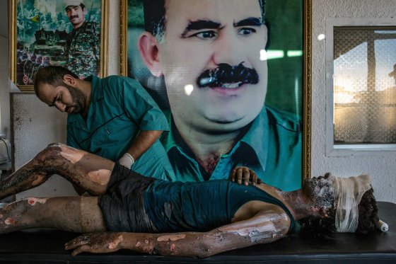 General News, 1st prize singles. A doctor rubs ointment on the burns of a 16-year-old Islamic State fighter named Jacob in front of a poster of Abdullah Ocalan, the jailed leader of the Kurdistan Workers' Party, at a Y.P.G. hospital compound on the outskirts of Hasaka, Syria on Aug. 1, 2015.