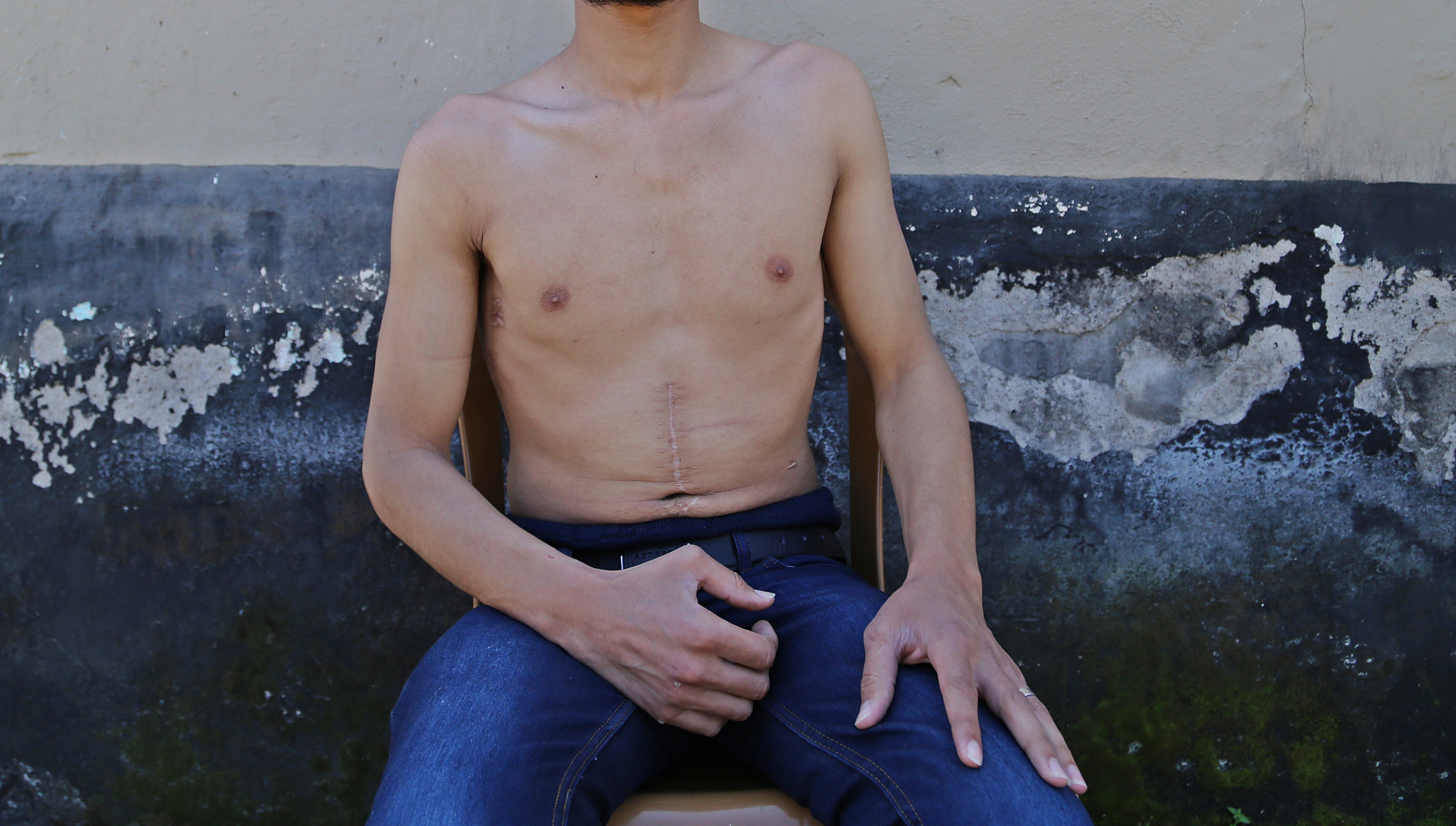 A man who says he was tortured in a Syrian prison is pictured in Hatay, Turkey, on March 29, 2014 (Cem Genco—Anadolu Agency/Getty Images)