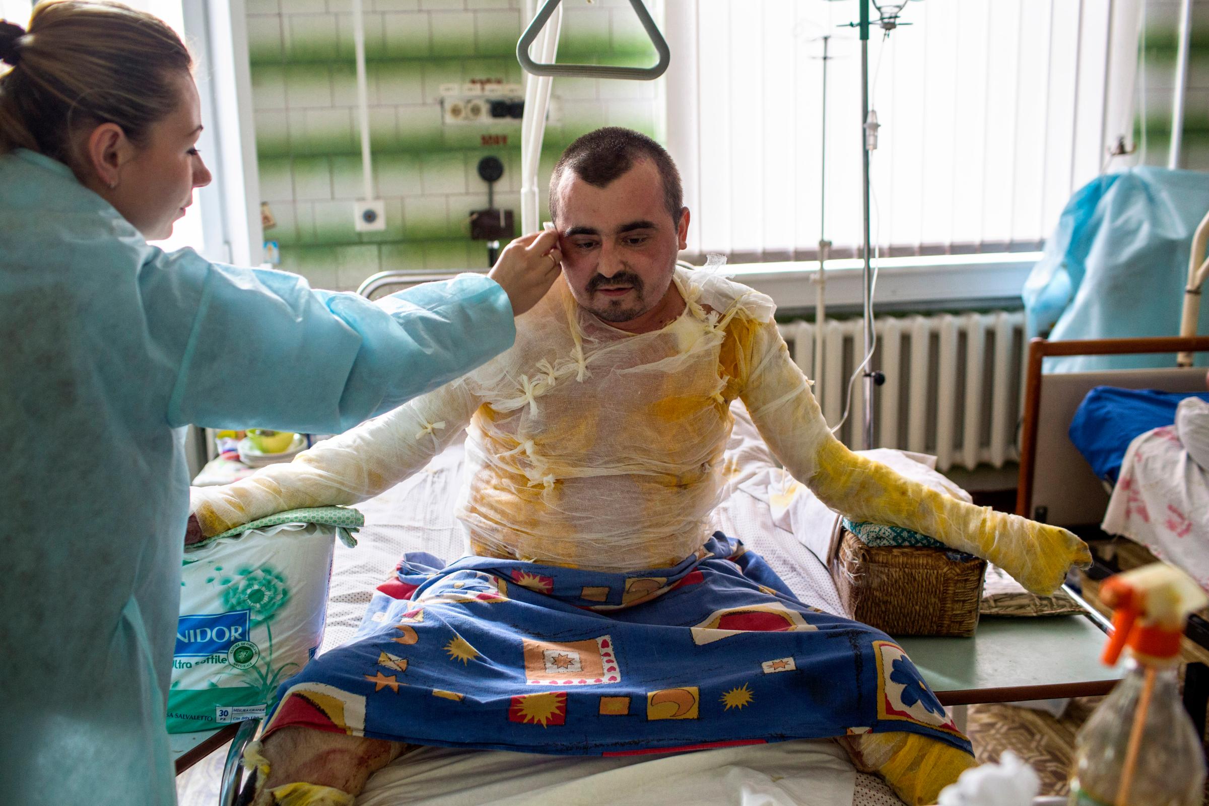 Svitlana Kapusta, 29, wipes the brow of her husband, Sgt. Sergey Masan, a Ukrainian paratrooper from the southern region of Mykolaiv, as he recovers in a hospital in Dnipropetrovsk, Ukraine, Sept. 29, 2014. Masan sustained burns to 70% of his body and lost several fingers in a grad rocket attack in the village of Dyakovo, in Luhansk Oblast near the Russian border, in July 2014. He spent approximately three months in the warzone and asserted that his brigade was frequently fired upon with grad rockets launched from Russia into Ukraine. "Our life has changed completely," Kapusta said.