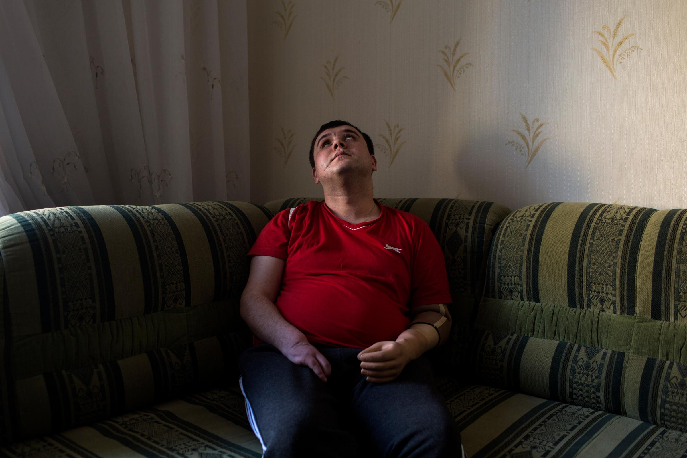 Ivan Kushnerov, 25, rests on a couch in an apartment where he is staying temporarily in Kiev, Ukraine, March 4, 2015. Kushnerov, who lives in Zaporizhia, was severely wounded in Severodonetsk in November 2014 while serving in the 39th Territorial Defense Battalion of the Ukrainian army. His left hand and three fingers on his right hand were amputated, and he has problems with his vision and legs. He worked in advertising before the war and is currently studying part-time to become a journalist. "I feel the pain. Sometimes it is phantom pain. I often have a headache, and my scars ache. This pain is always with me. But, if you feel pain, it means you are alive," he said. "I am now distracted by a lot of things. I require medical treatment, but I want to tighten my fists and go there [to war] because I am very worried about my guys. However, I realize that I will be only a burden for them now."