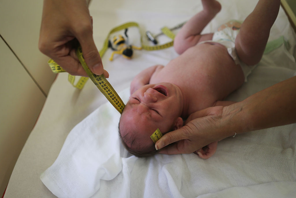 Dr. Vanessa Van Der Linden, the neuro-pediatrician who first recognized and alerted authorities over the microcephaly crisis in Brazil, measures the head of a 2-month-old baby with microcephaly on Jan. 27, 2016 in Recife, Brazil. (Mario Tama-Getty Images)