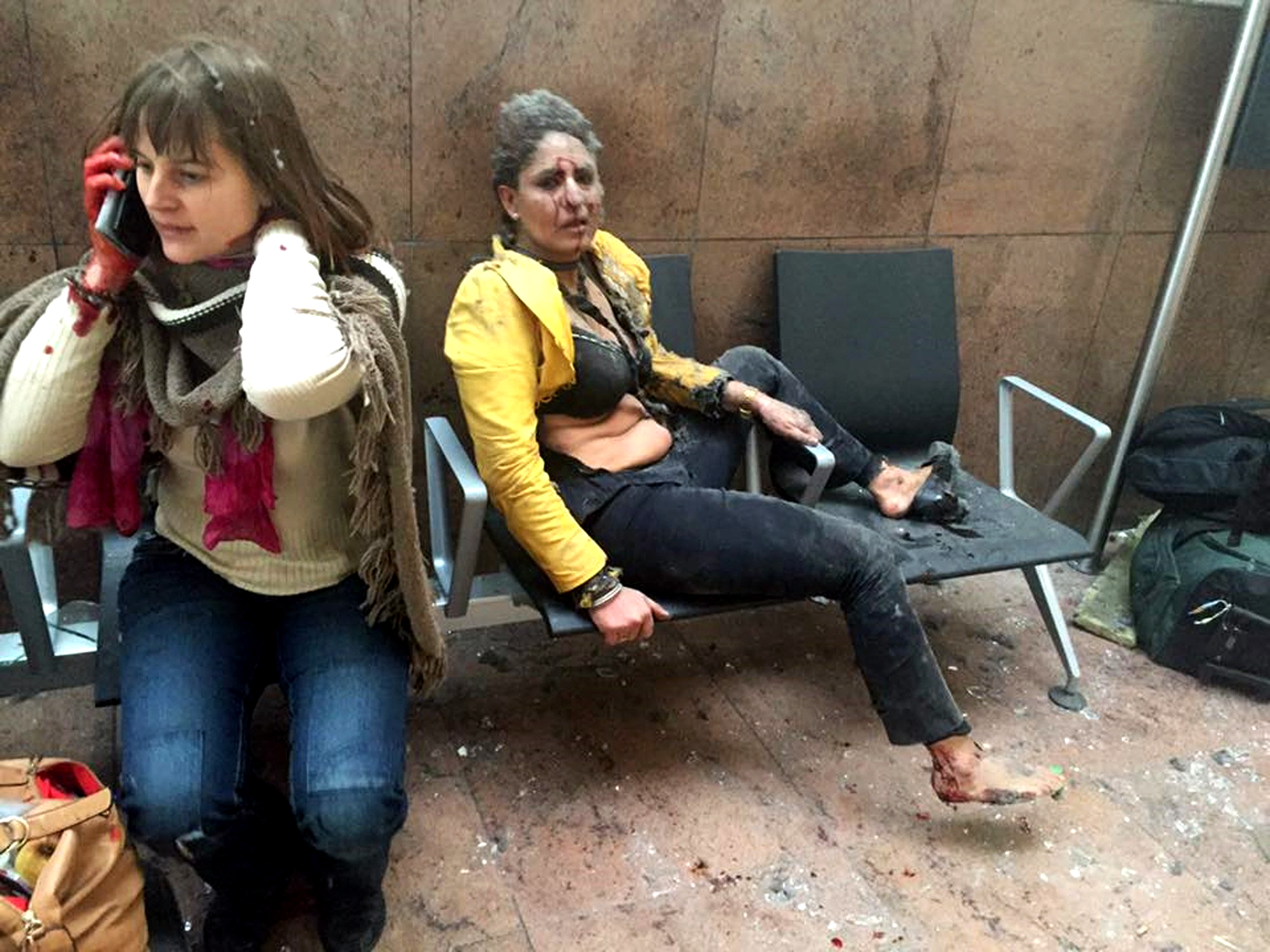 In this photo provided by Georgian Public Broadcaster and photographed by Ketevan Kardava, two women are wounded in Brussels Airport in Belgium after explosions were heard on March 22, 2016.