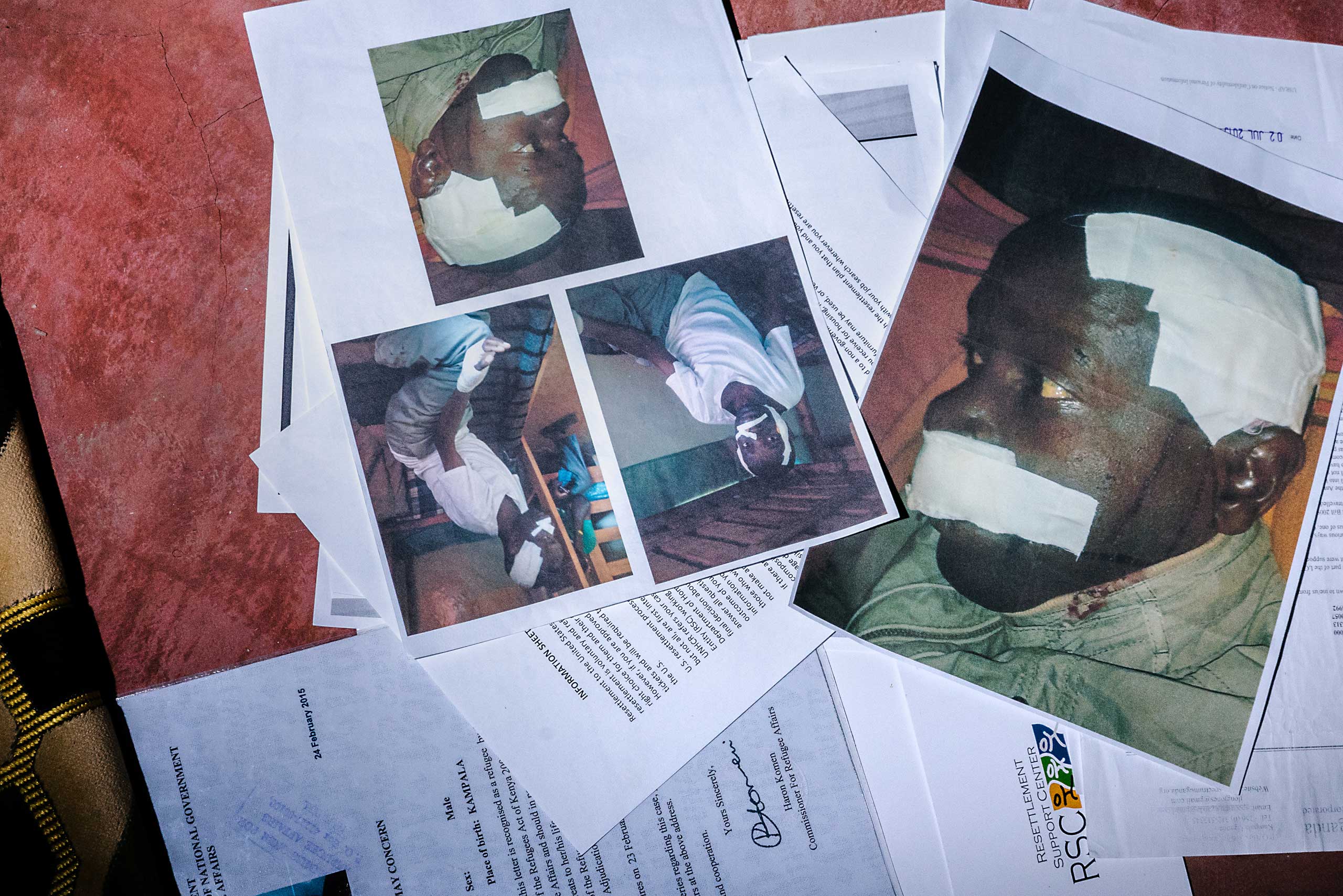 Soon after arriving in Kenya, S. says he was attacked by seven men with machetes. Here, evidence of his attack that he submitted as part of his resettlement application. He has since been resettled in the U.S.