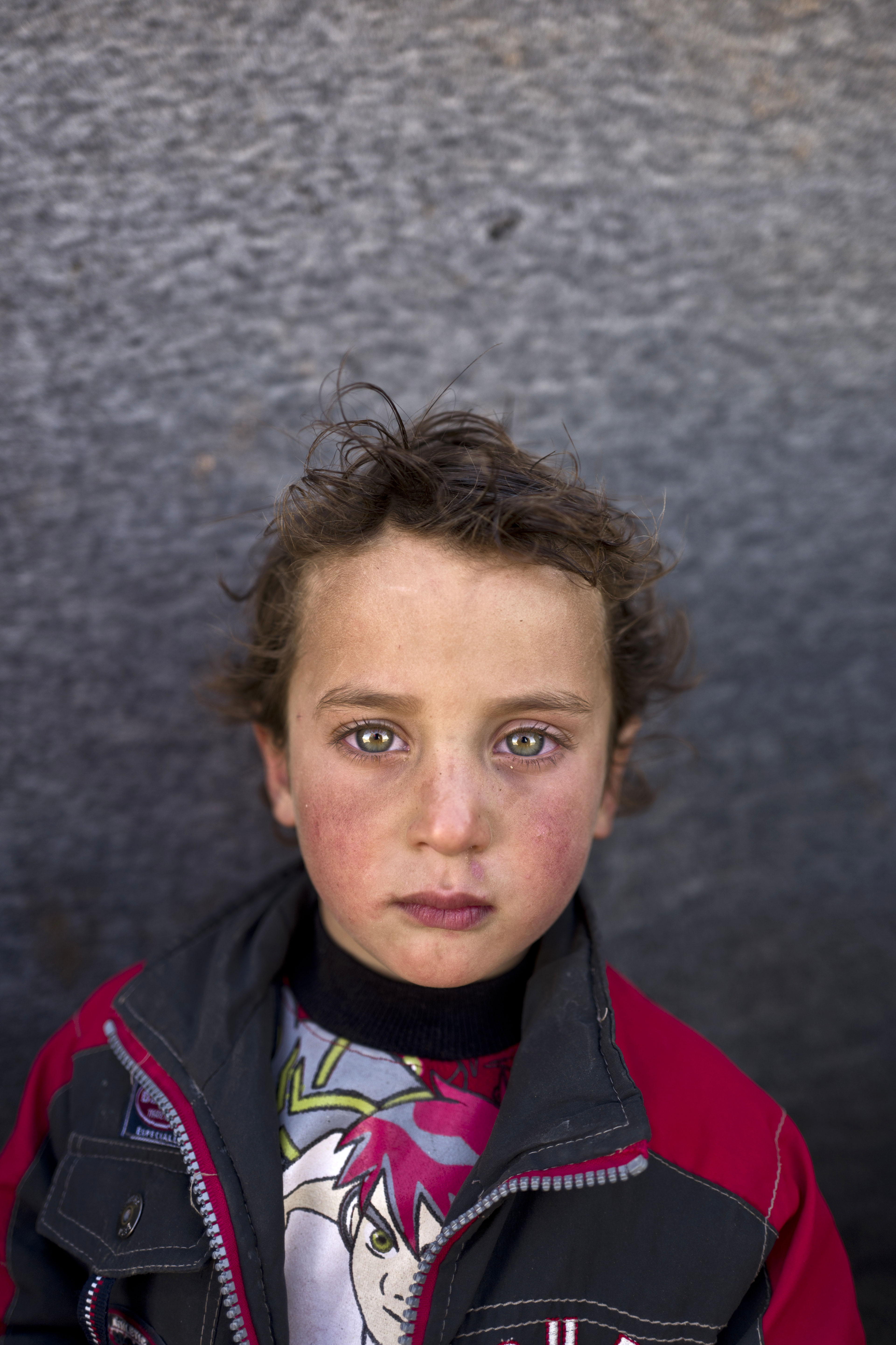 Hammad Khadir, 3, from Hassakeh.