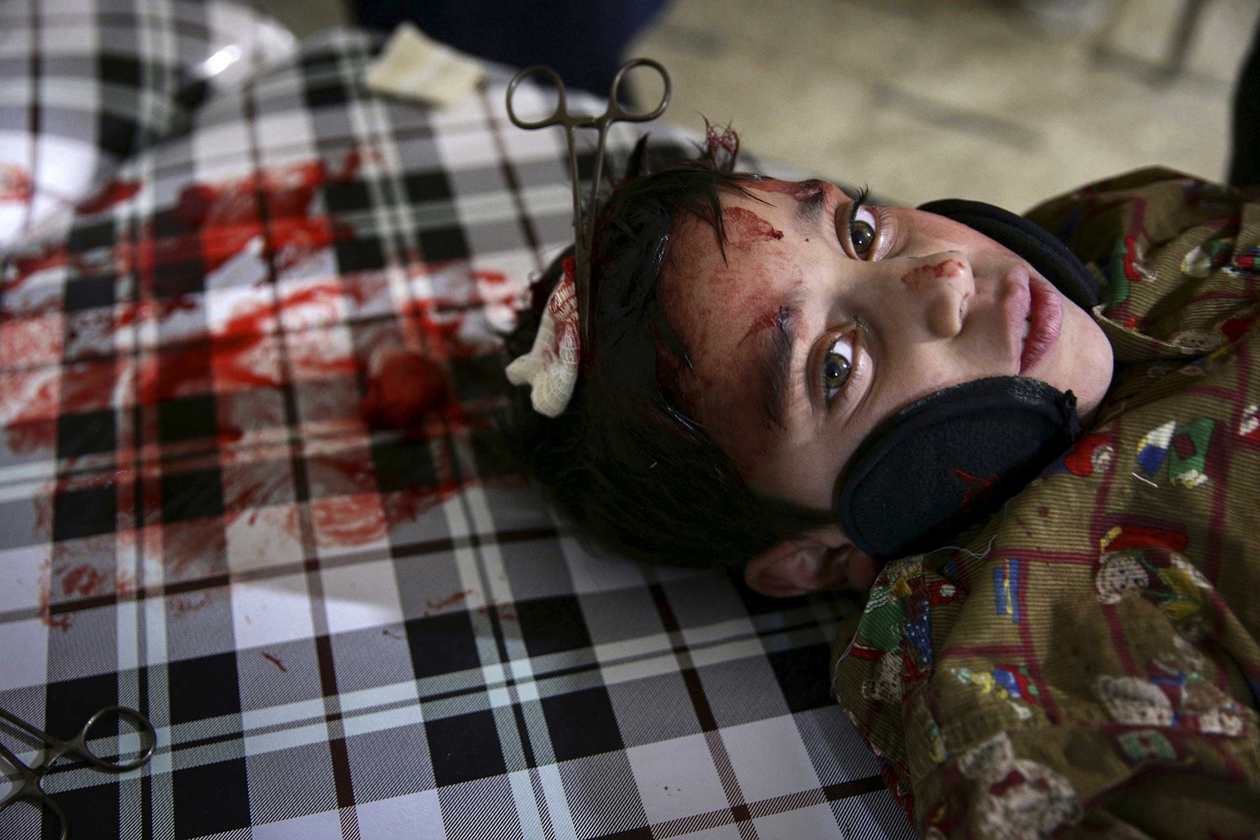 An injured boy undergoing surgery, after he was injured in what activists said was an airstrike by forces loyal to Syria's president Bashar al-Assad, rests inside a field hospital in the Douma neighborhood of Damascus, Syria, Dec. 5, 2015.