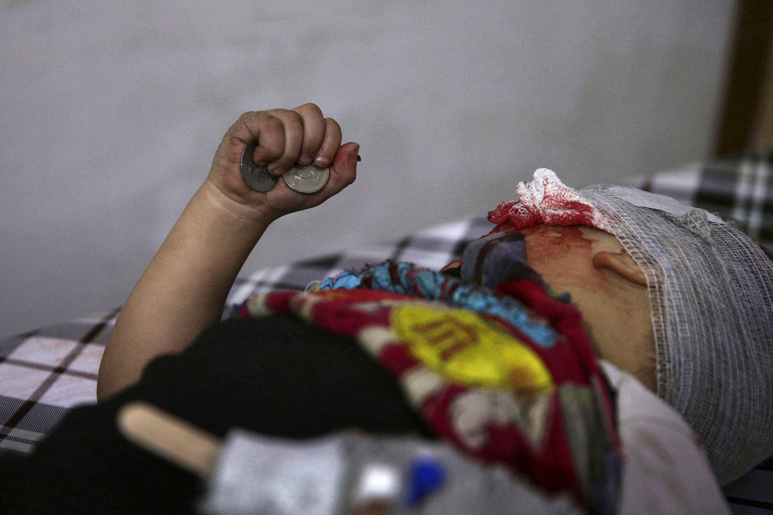 An injured child holds coins in his hand as he lies on a bed inside a field hospital, after what activists said was shelling by forces loyal to Syria's President Bashar al-Assad, in the Douma neighborhood of Damascus, Syria, Nov. 29, 2015.