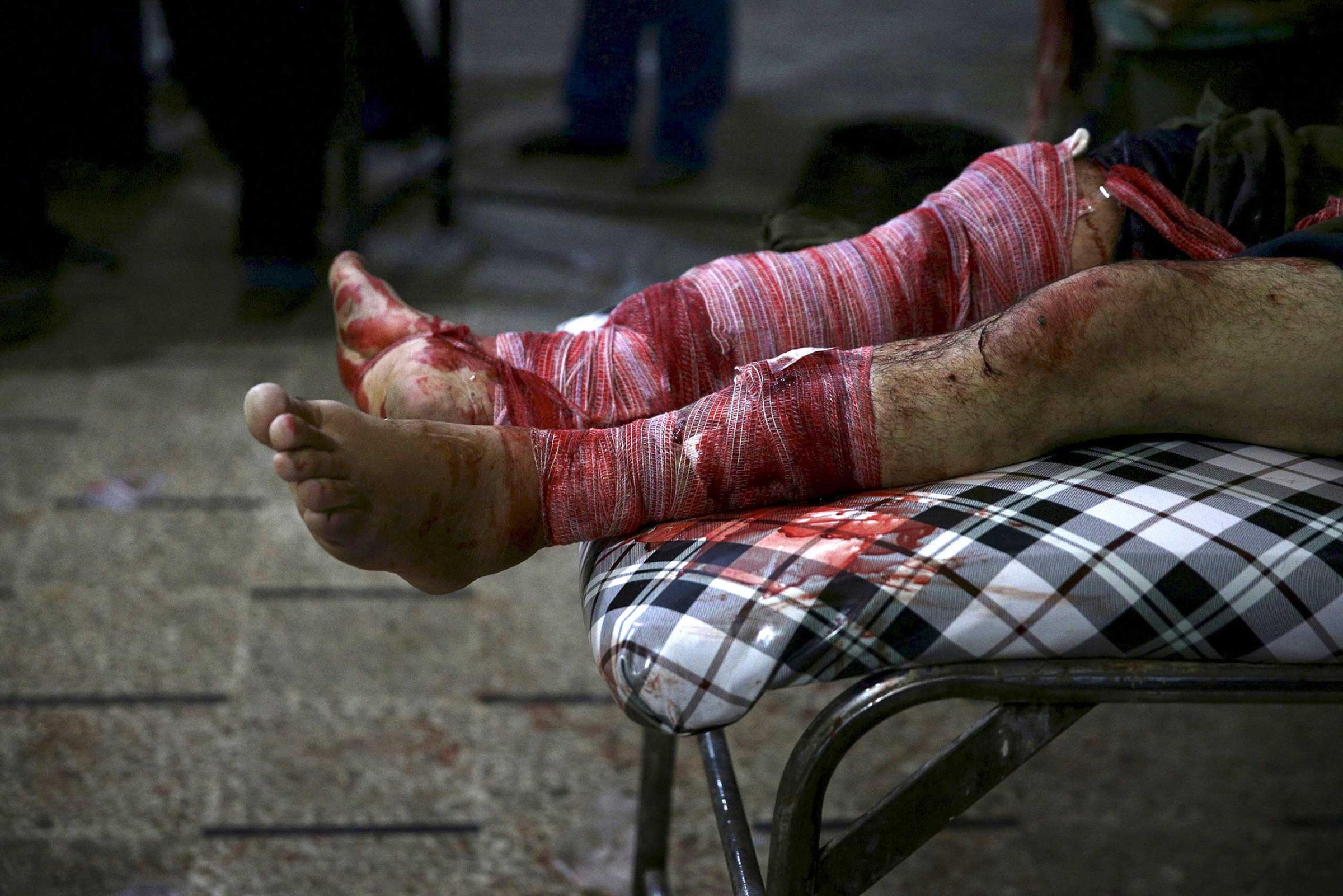 A man, injured in what activists said was an airstrike by forces loyal to Syria's president Bashar al-Assad, lies in a field hospital in the Douma neighborhood of Damascus, Syria December 6, 2015.
