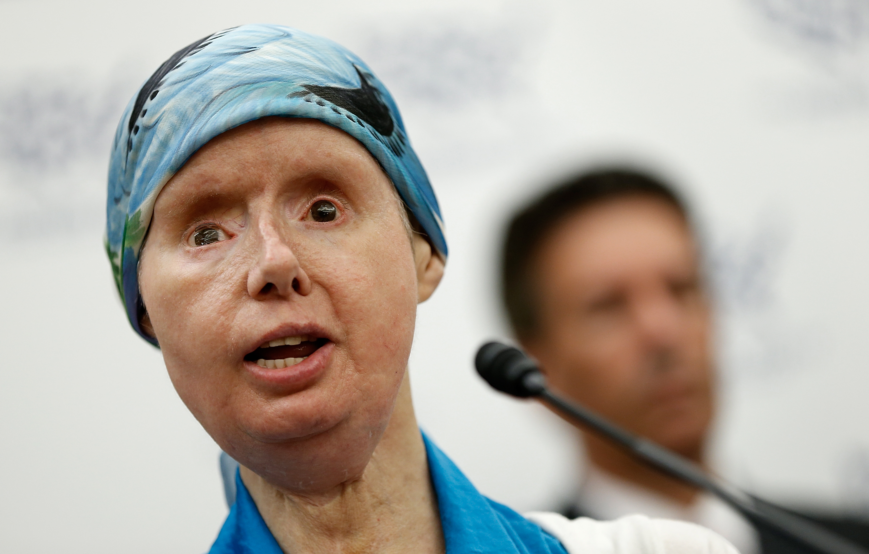Charla Nash, the victim of a mauling by a pet chimp in Connecticut in 2009 and who underwent a face transplant, speaks at a press conference July 10, 2014 on Capitol Hill in Washington, DC. (Win McNamee/Getty Images)