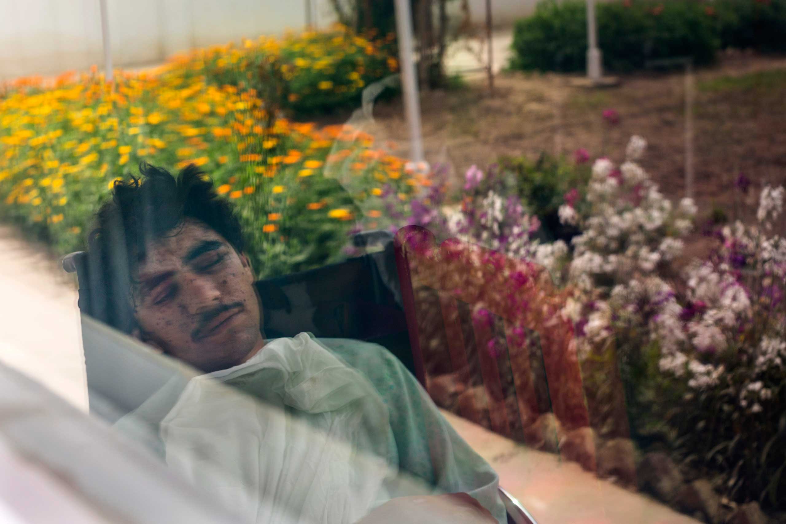 Kharim Ahmad, 22, suffered shrapnel wounds on his face and the loss of a leg from fighting in Sangin. He was being treated at the Emergency hospital in Lashkar Gah, Afghanistan on March 25, 2015.