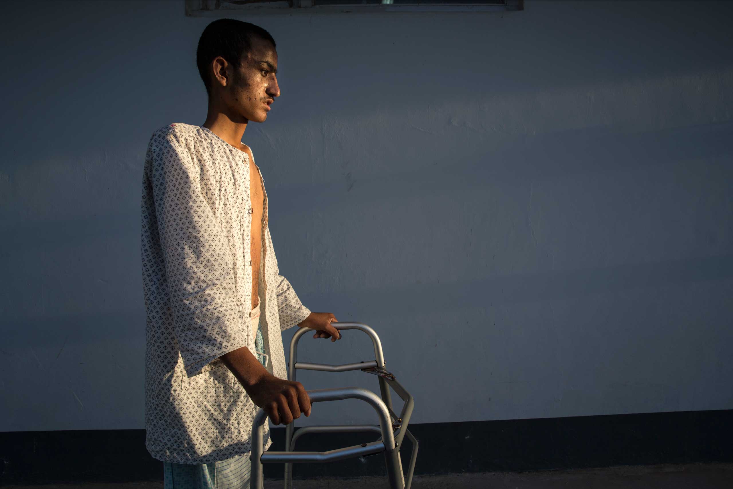 Ahah Kahn, 19, is barely able to walk after a serious brain injury caused by an IED. Atah was a sheep herder from Helmand who had been at the hospital for a month recovering his strength. Lashkar Gah, Afghanistan on March 26, 2015.